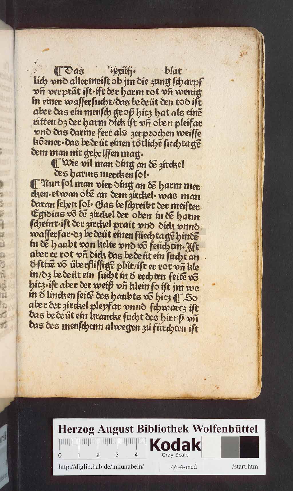 http://diglib.hab.de/inkunabeln/46-4-med/00049.jpg