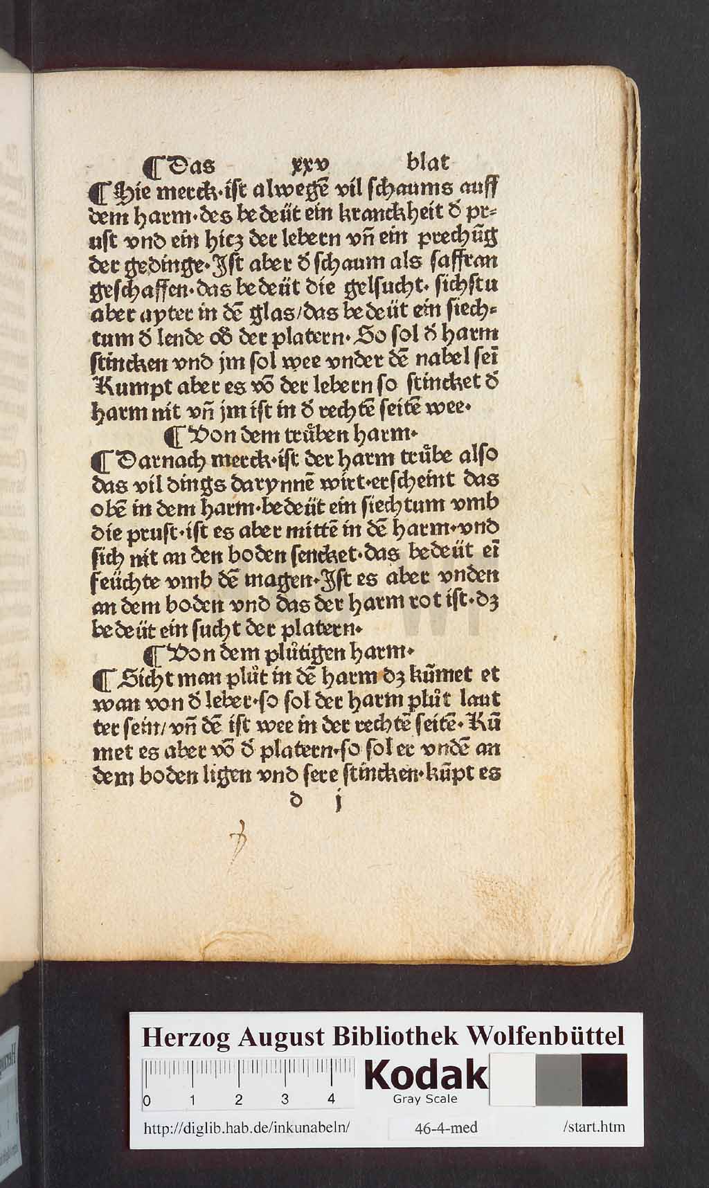 http://diglib.hab.de/inkunabeln/46-4-med/00051.jpg