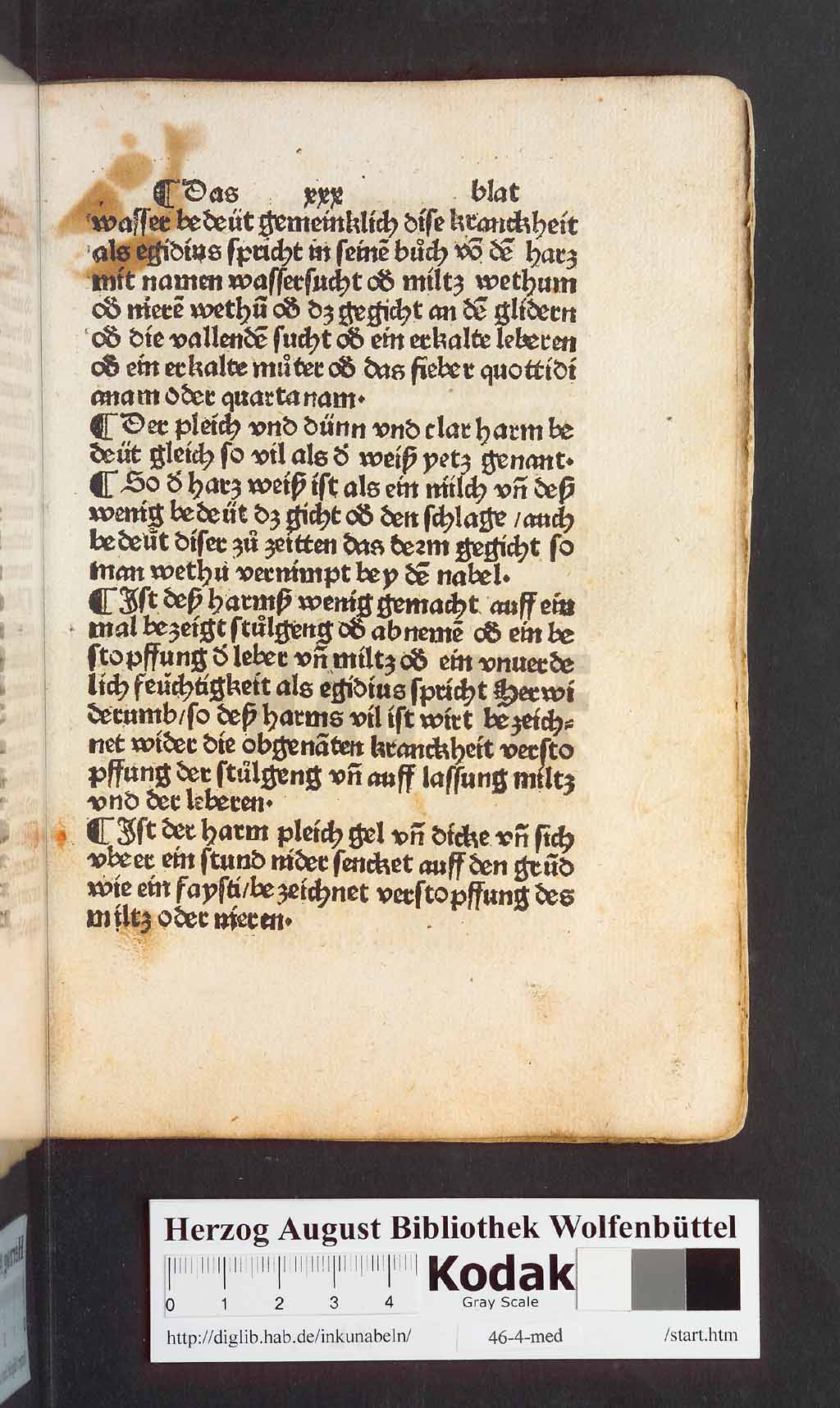 http://diglib.hab.de/inkunabeln/46-4-med/00061.jpg