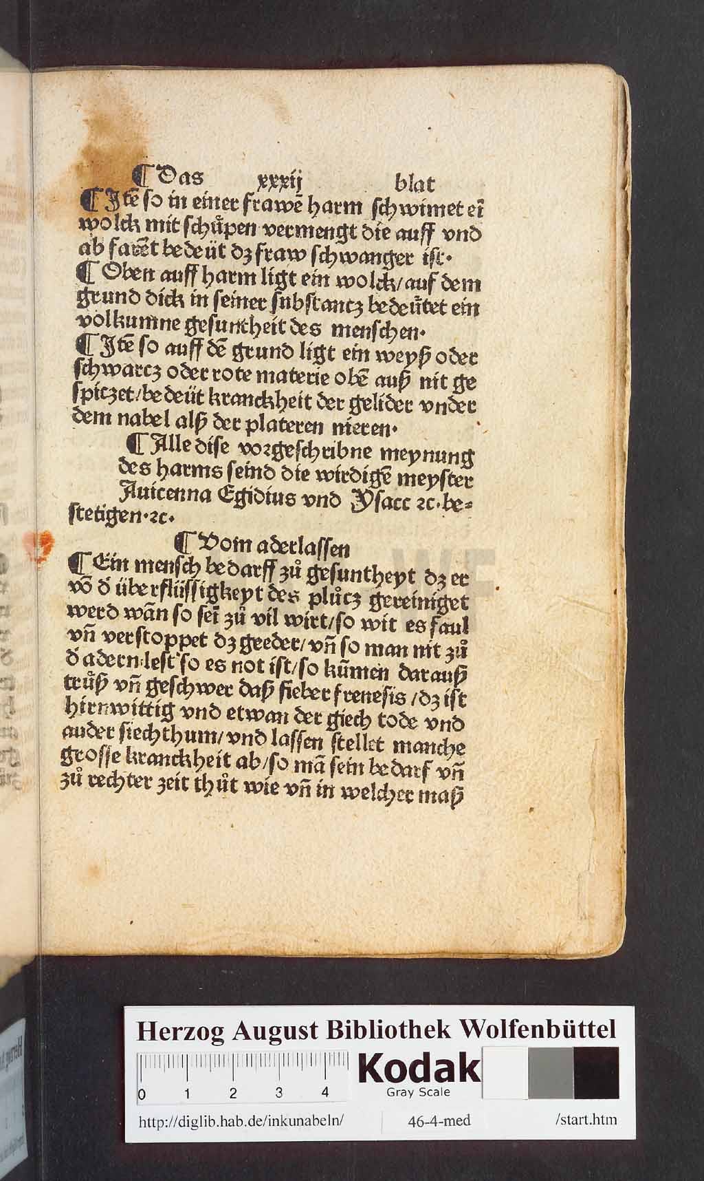 http://diglib.hab.de/inkunabeln/46-4-med/00065.jpg
