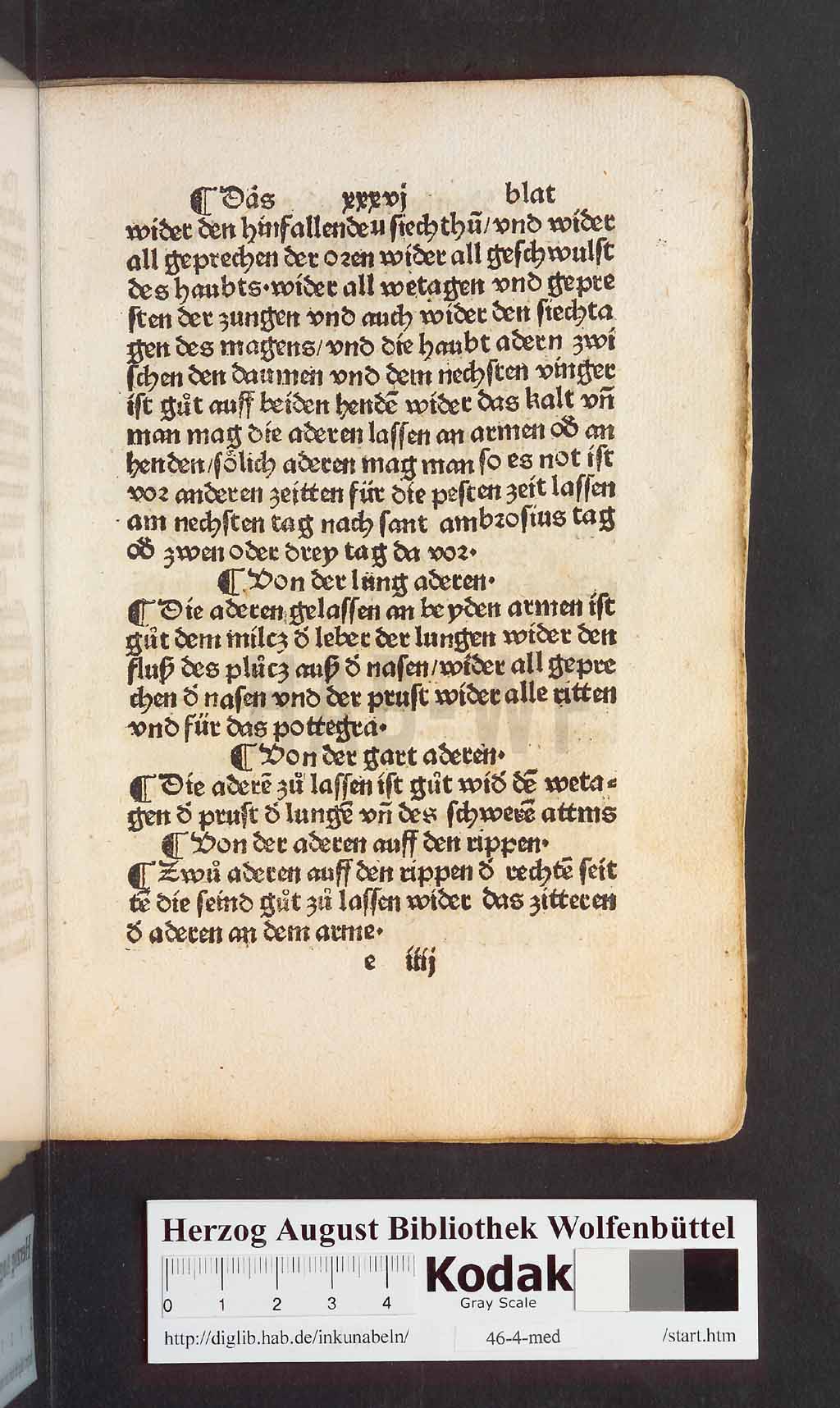 http://diglib.hab.de/inkunabeln/46-4-med/00073.jpg