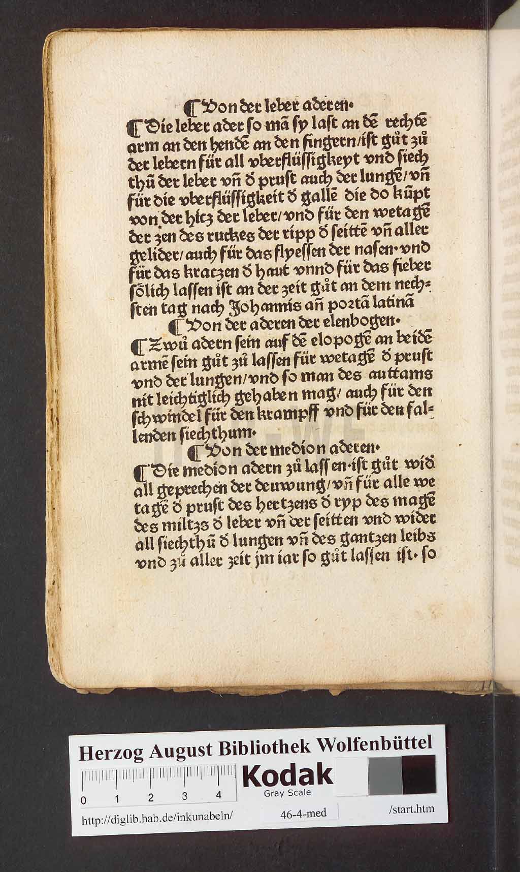 http://diglib.hab.de/inkunabeln/46-4-med/00074.jpg