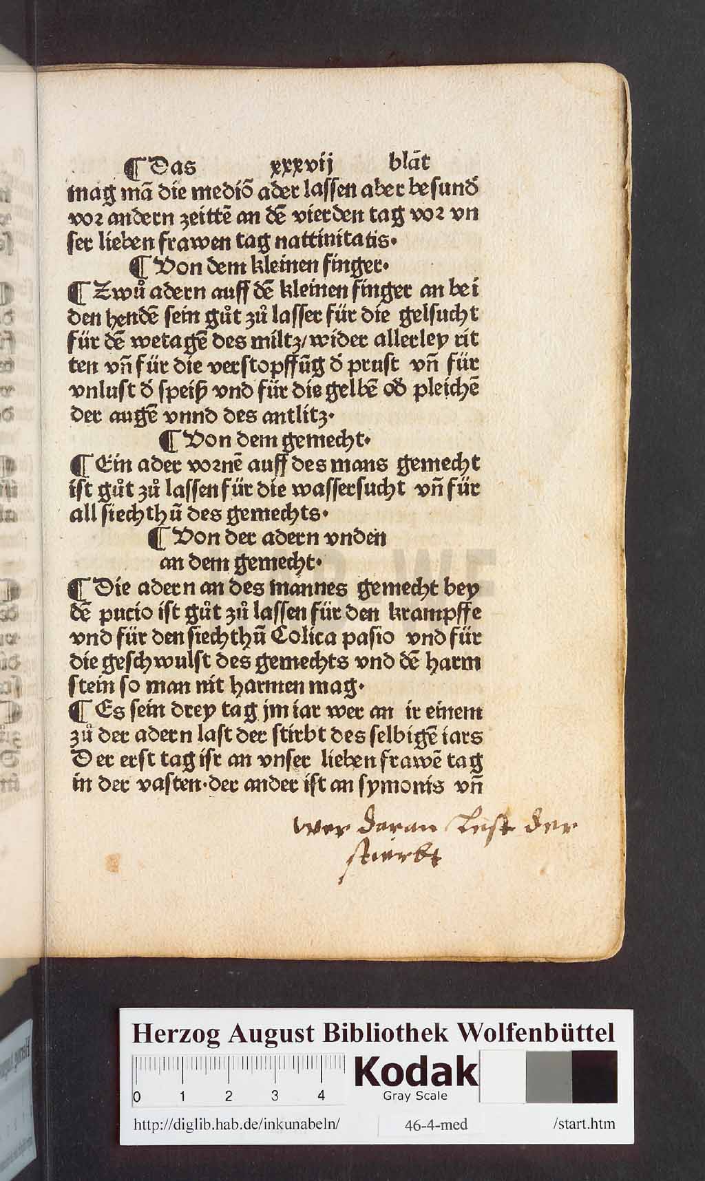 http://diglib.hab.de/inkunabeln/46-4-med/00075.jpg