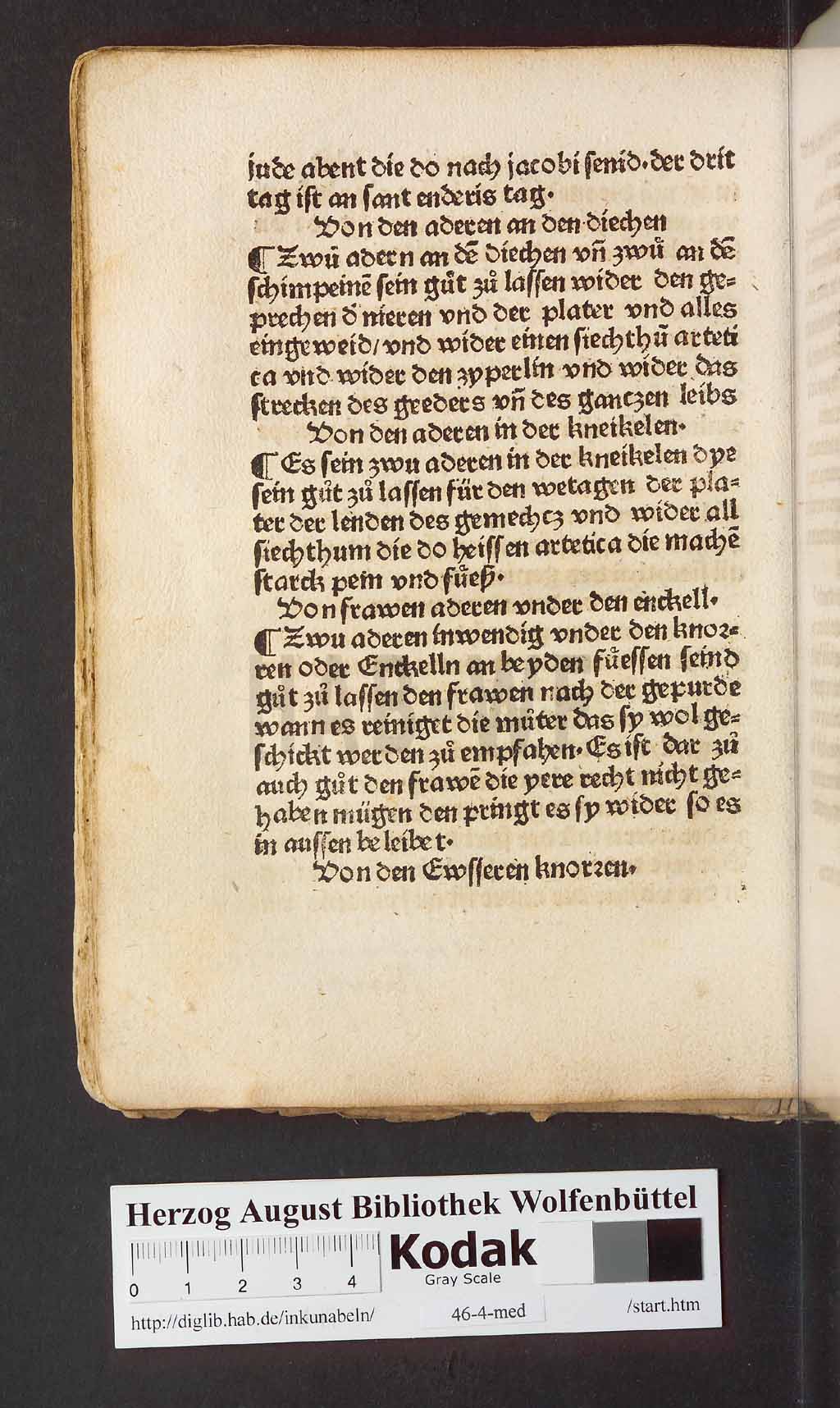 http://diglib.hab.de/inkunabeln/46-4-med/00076.jpg