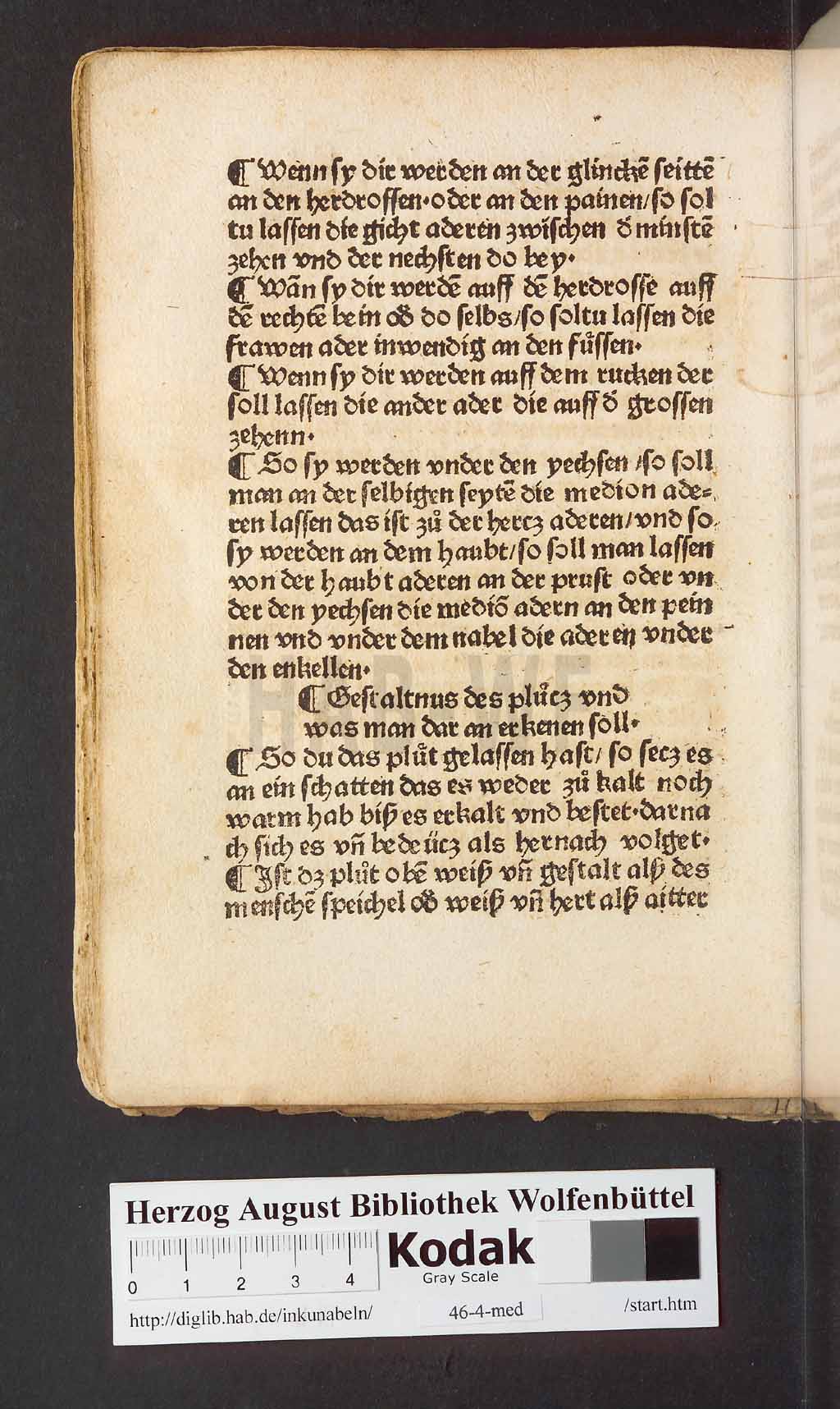 http://diglib.hab.de/inkunabeln/46-4-med/00080.jpg