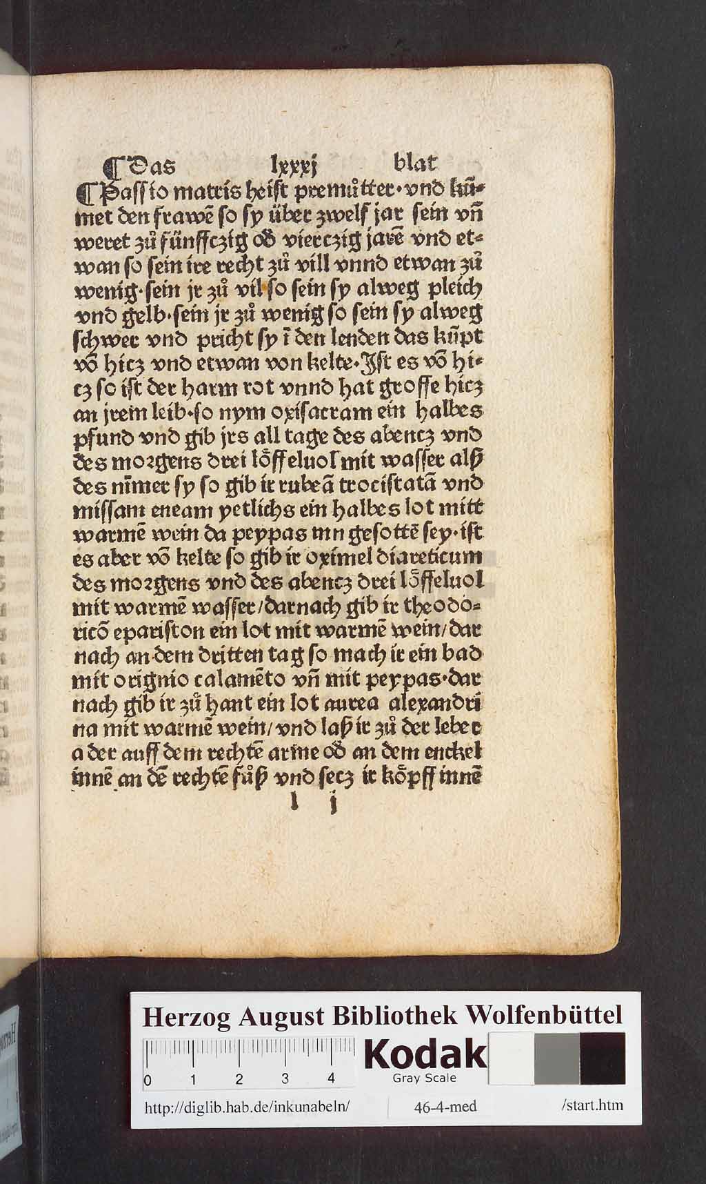 http://diglib.hab.de/inkunabeln/46-4-med/00163.jpg