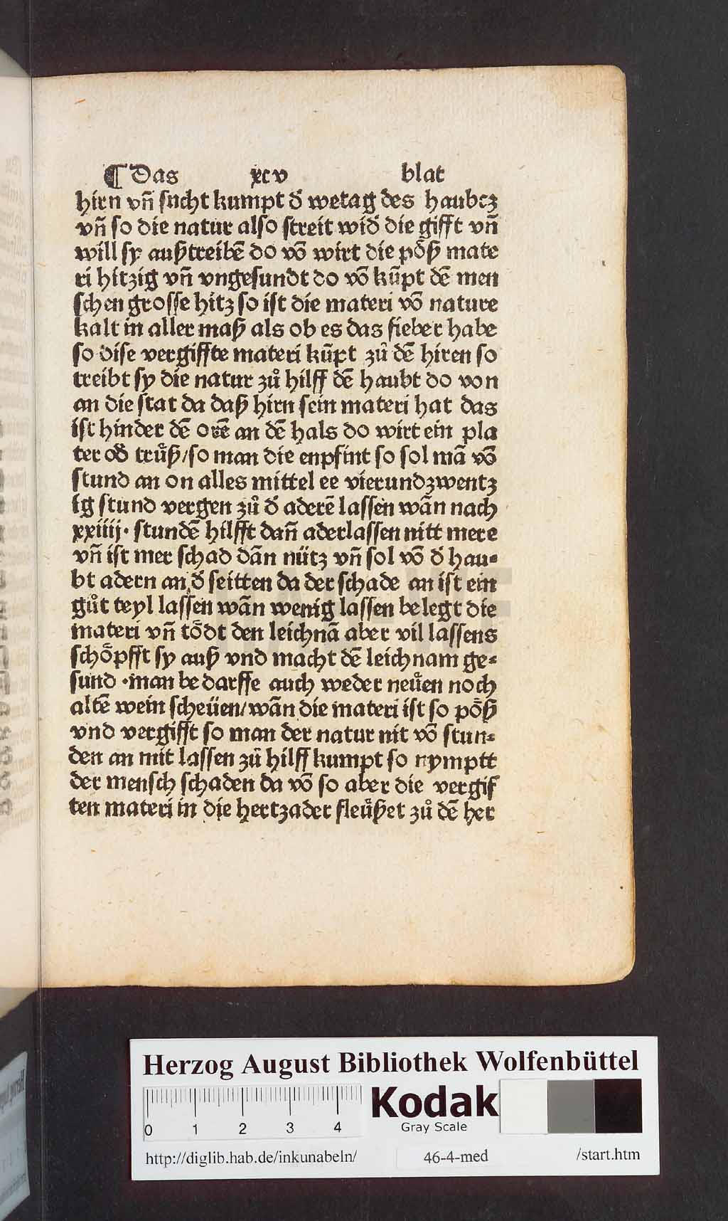 http://diglib.hab.de/inkunabeln/46-4-med/00191.jpg