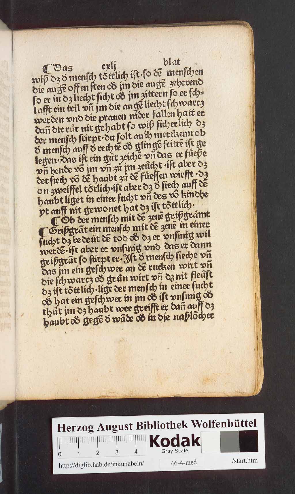 http://diglib.hab.de/inkunabeln/46-4-med/00283.jpg