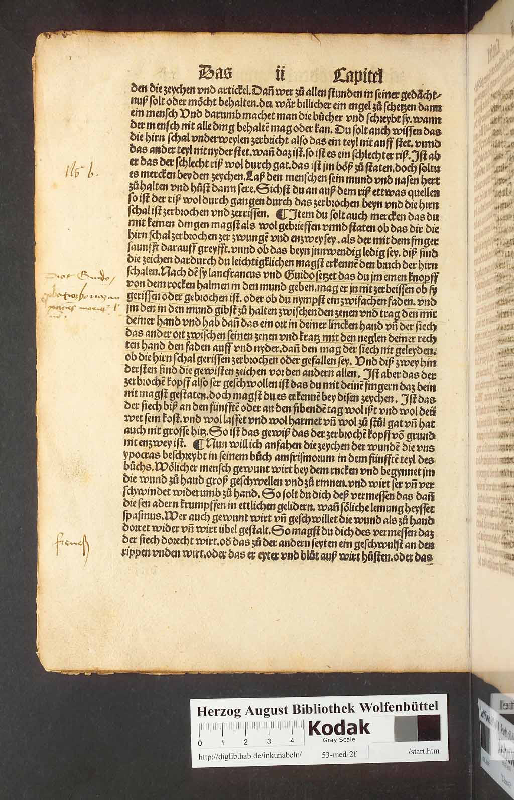 http://diglib.hab.de/inkunabeln/53-med-2f/00020.jpg