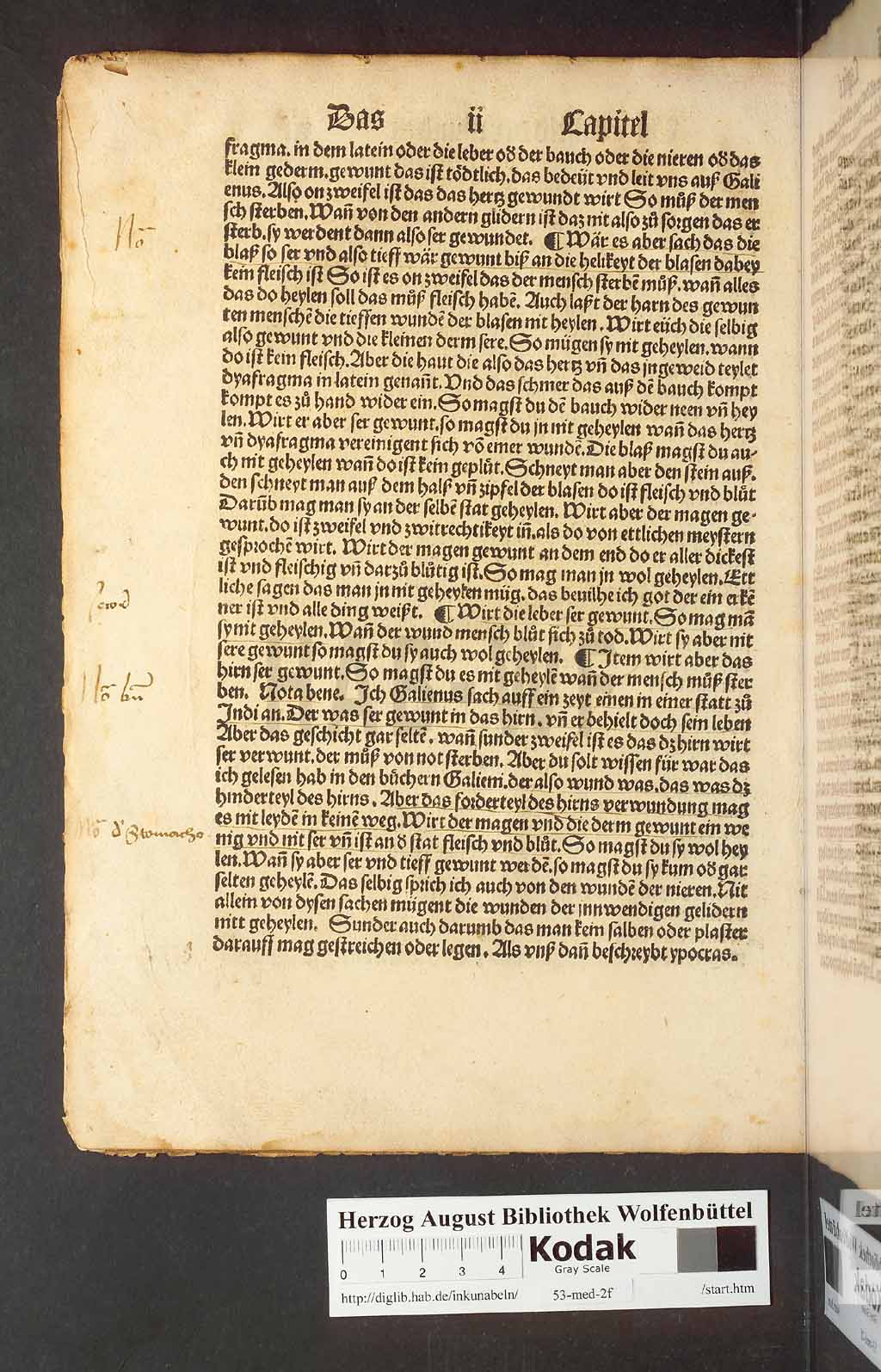 http://diglib.hab.de/inkunabeln/53-med-2f/00022.jpg
