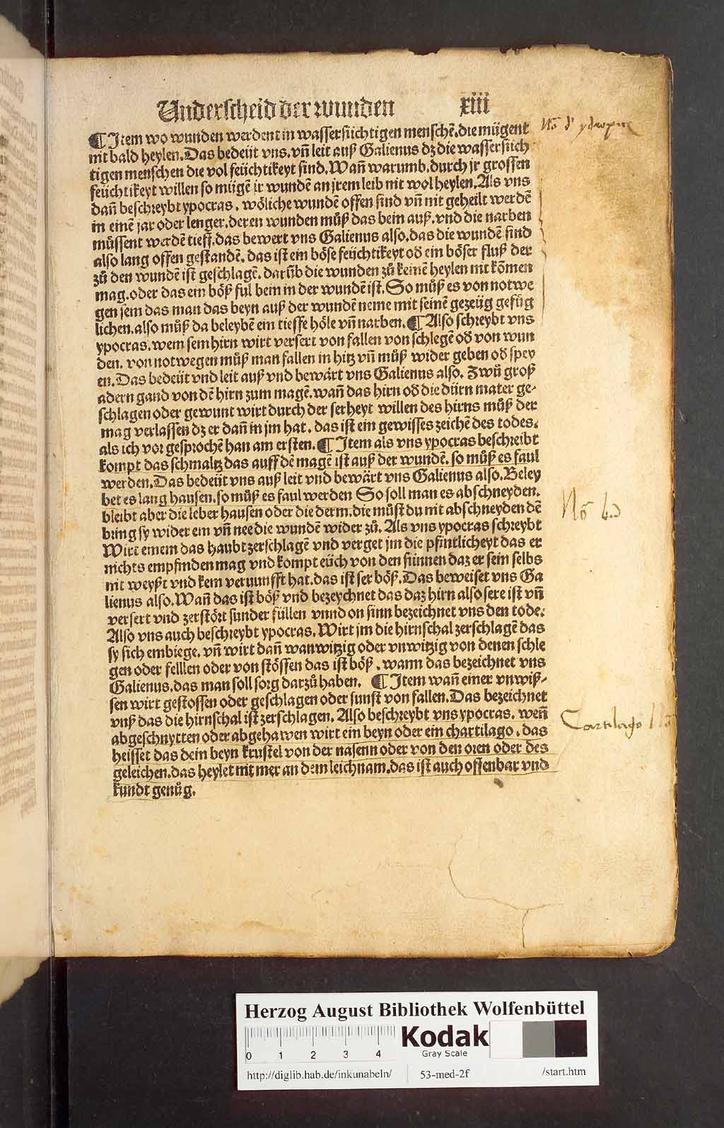 http://diglib.hab.de/inkunabeln/53-med-2f/00023.jpg
