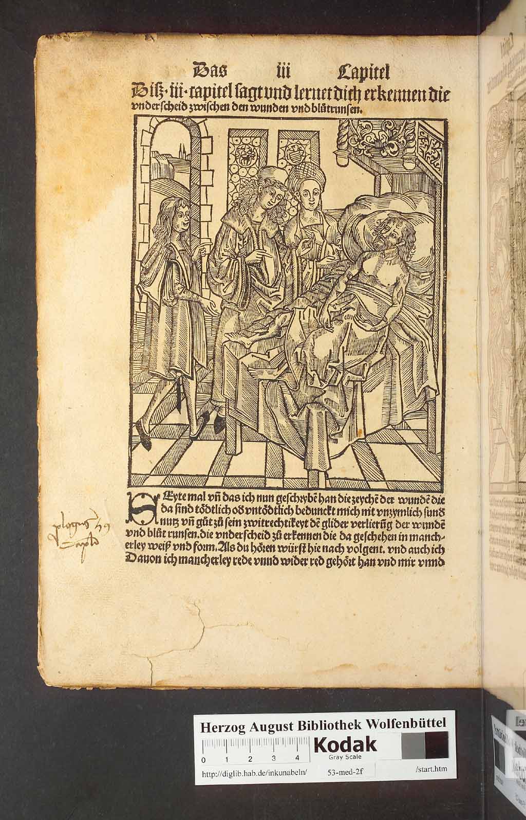 http://diglib.hab.de/inkunabeln/53-med-2f/00024.jpg