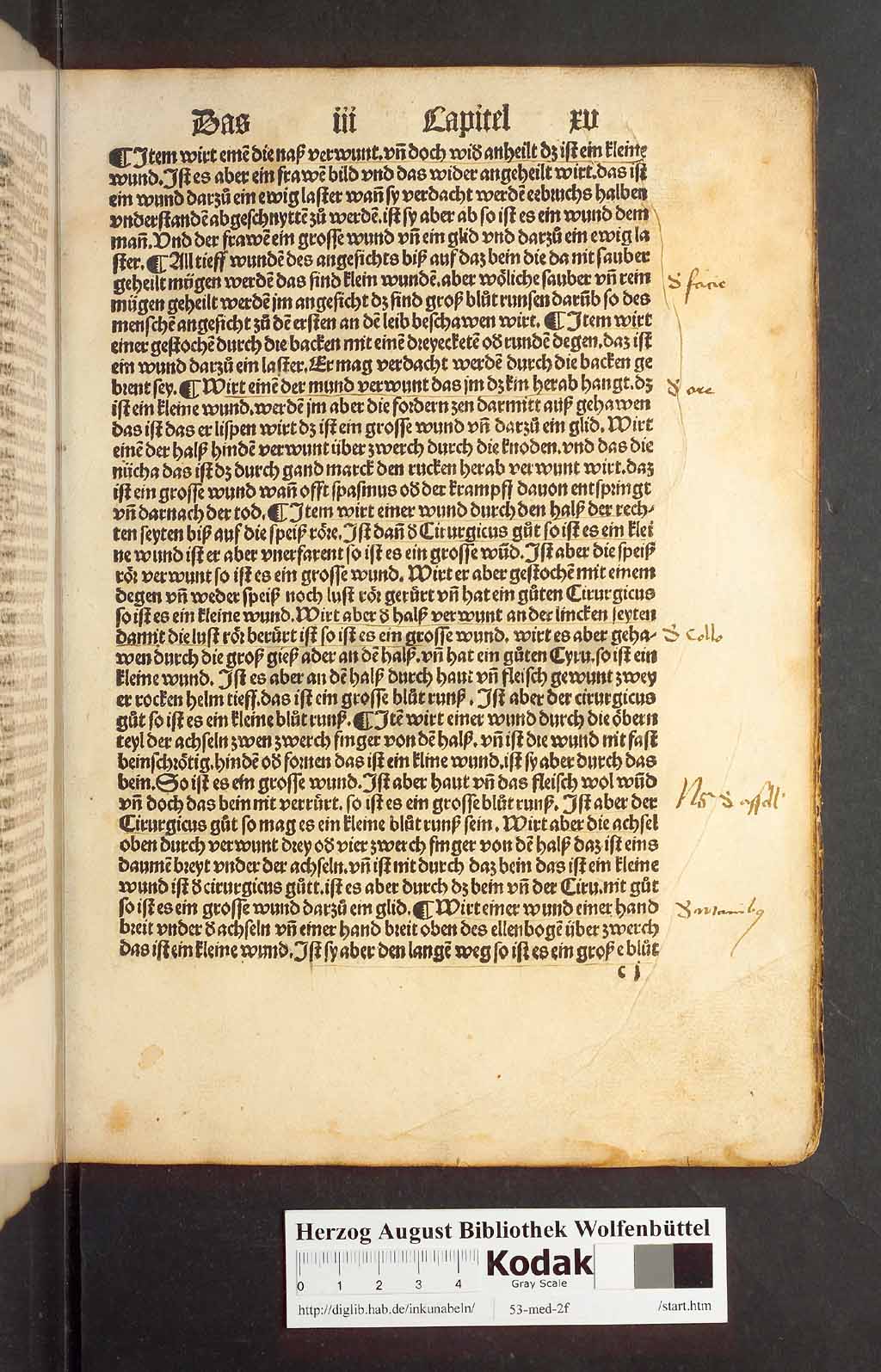 http://diglib.hab.de/inkunabeln/53-med-2f/00027.jpg