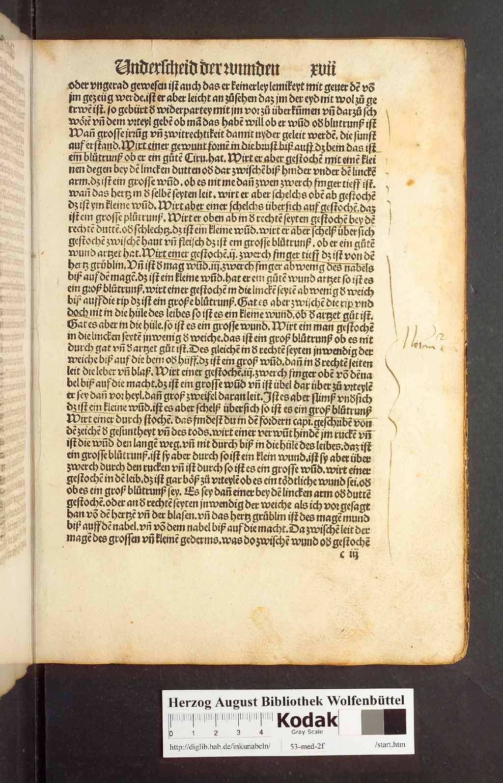 http://diglib.hab.de/inkunabeln/53-med-2f/00031.jpg