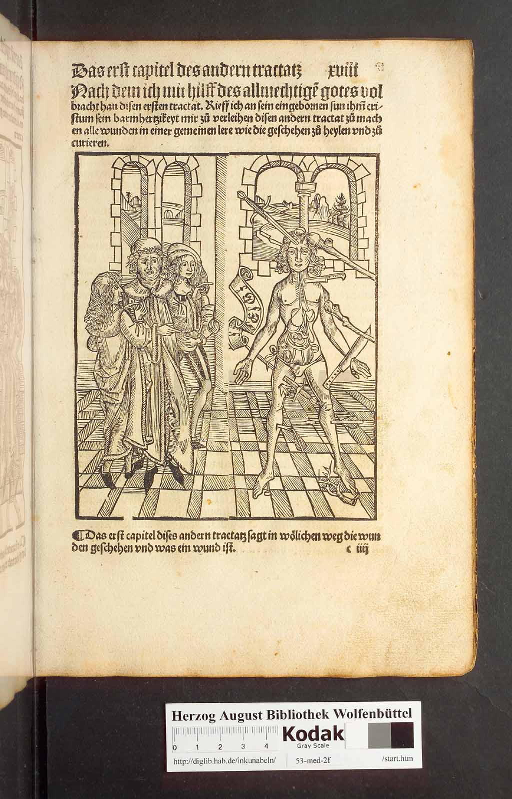 http://diglib.hab.de/inkunabeln/53-med-2f/00033.jpg