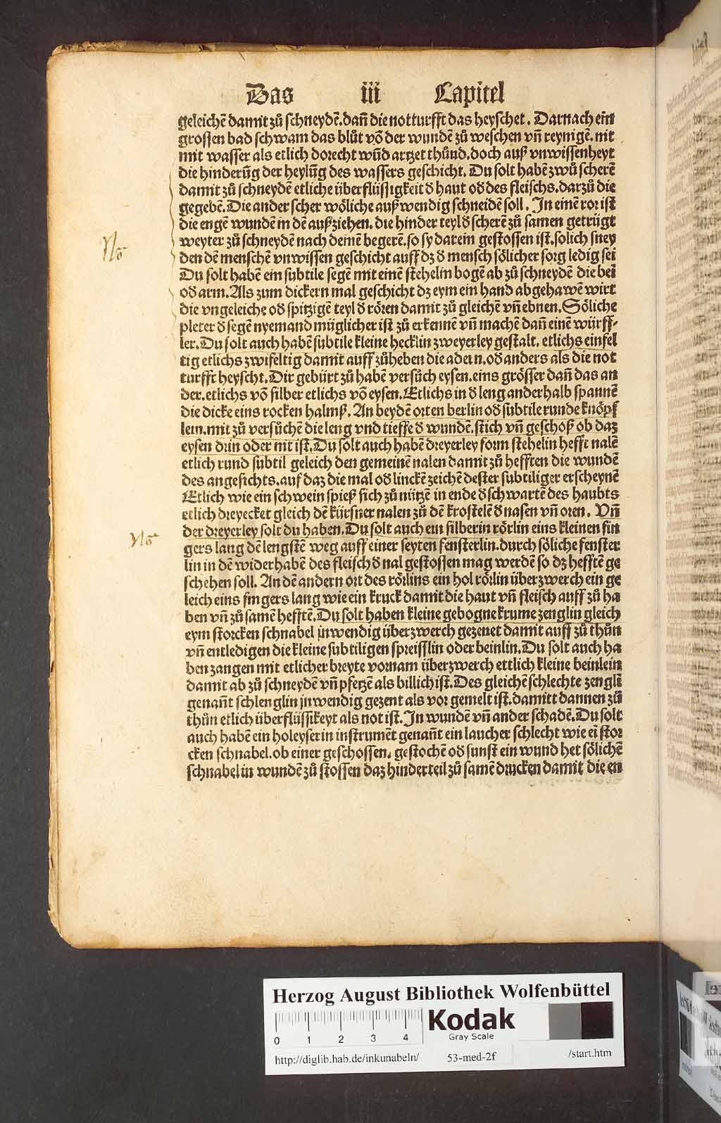 http://diglib.hab.de/inkunabeln/53-med-2f/00036.jpg