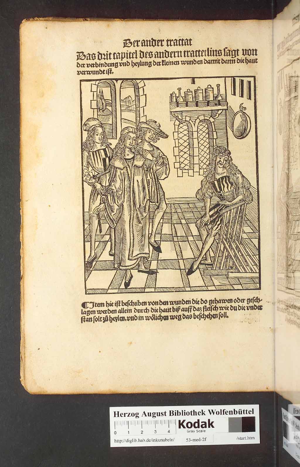 http://diglib.hab.de/inkunabeln/53-med-2f/00038.jpg