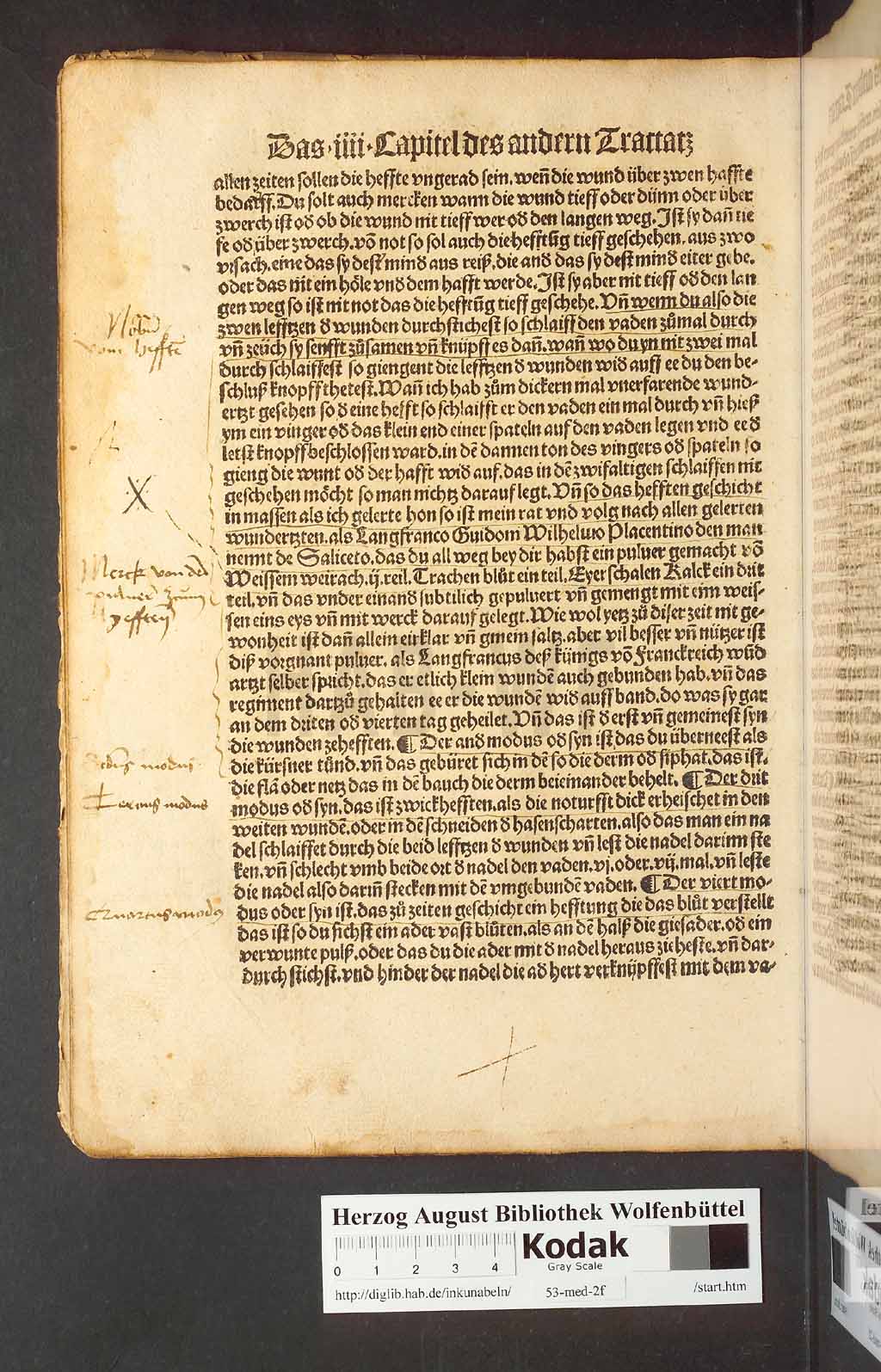 http://diglib.hab.de/inkunabeln/53-med-2f/00040.jpg