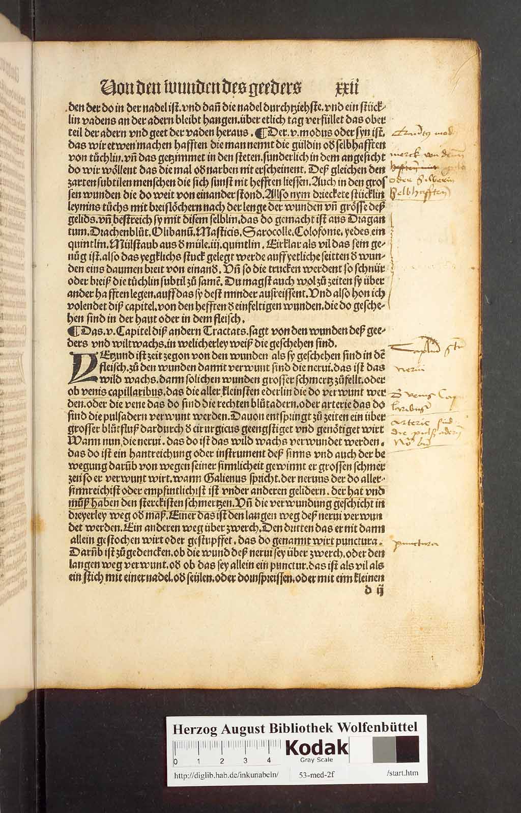 http://diglib.hab.de/inkunabeln/53-med-2f/00041.jpg