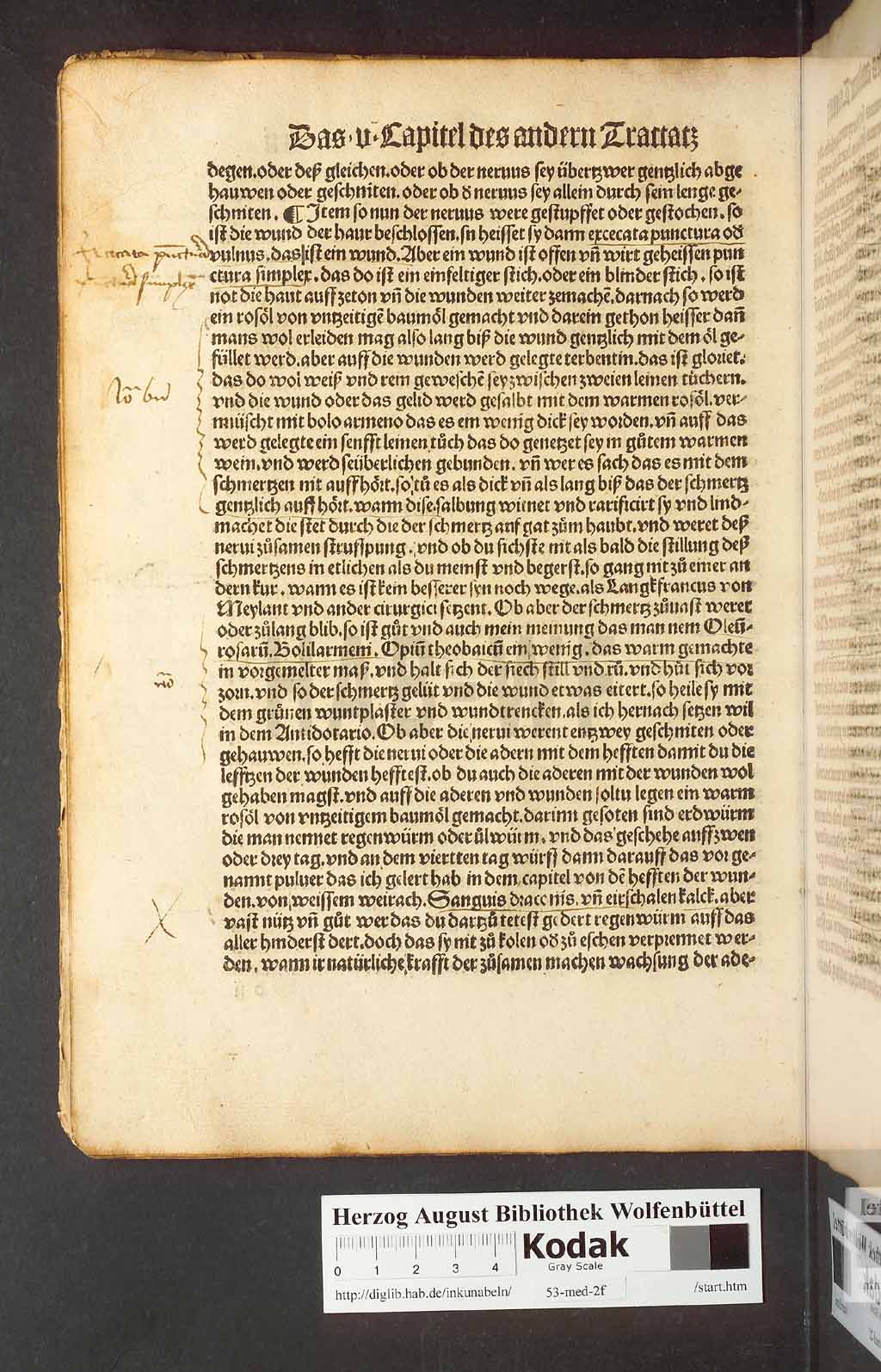 http://diglib.hab.de/inkunabeln/53-med-2f/00042.jpg