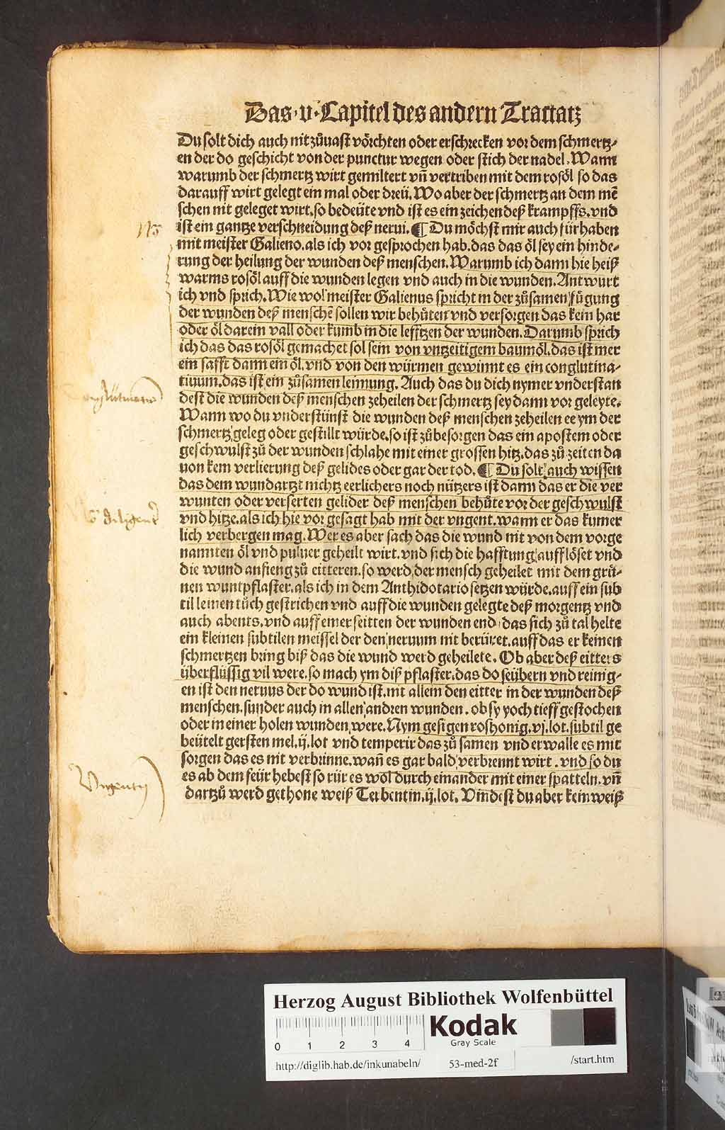 http://diglib.hab.de/inkunabeln/53-med-2f/00044.jpg