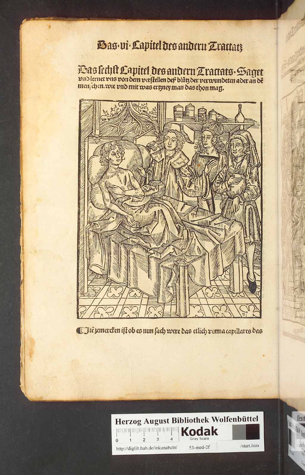 http://diglib.hab.de/inkunabeln/53-med-2f/00046.jpg