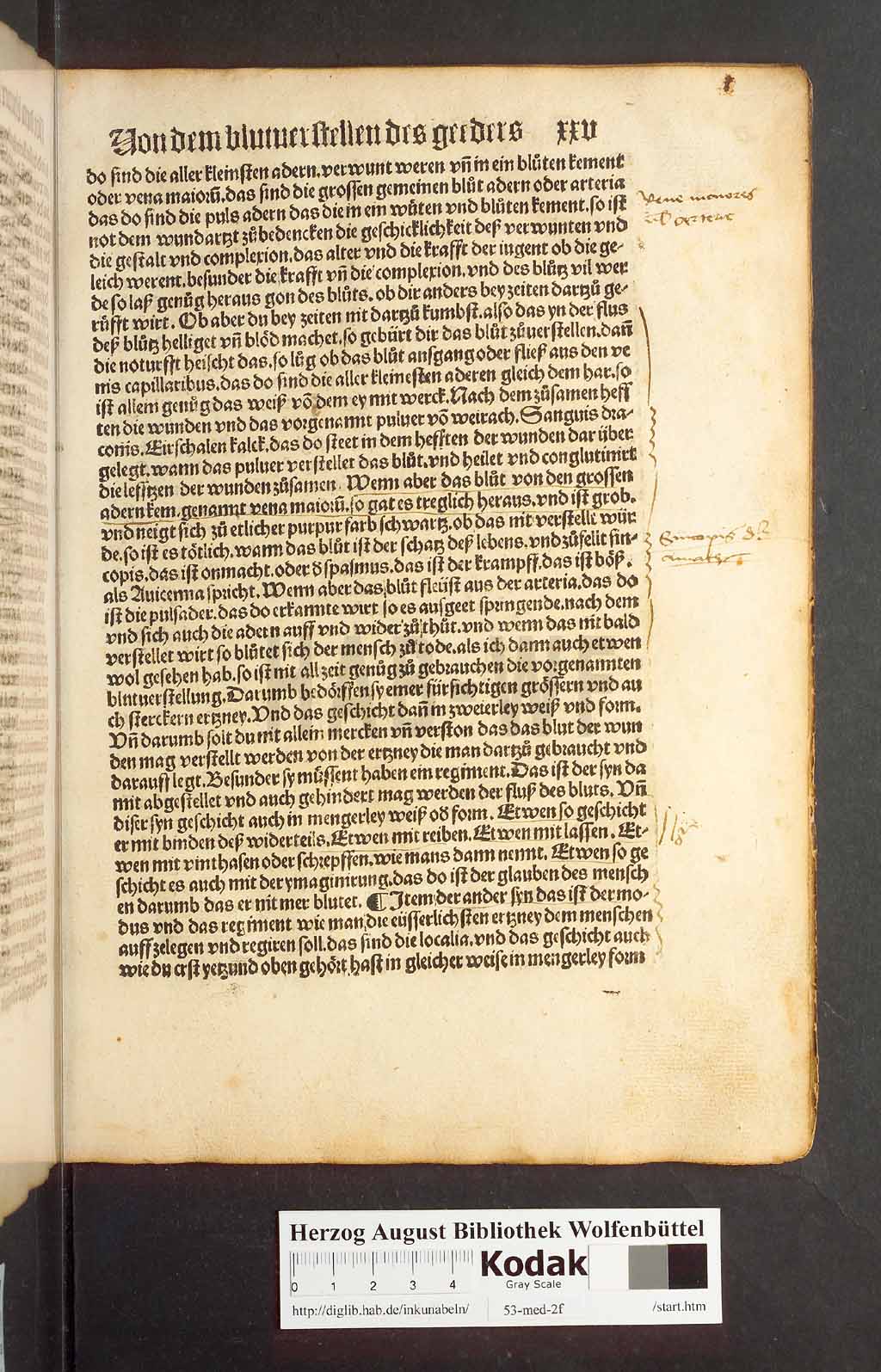 http://diglib.hab.de/inkunabeln/53-med-2f/00047.jpg