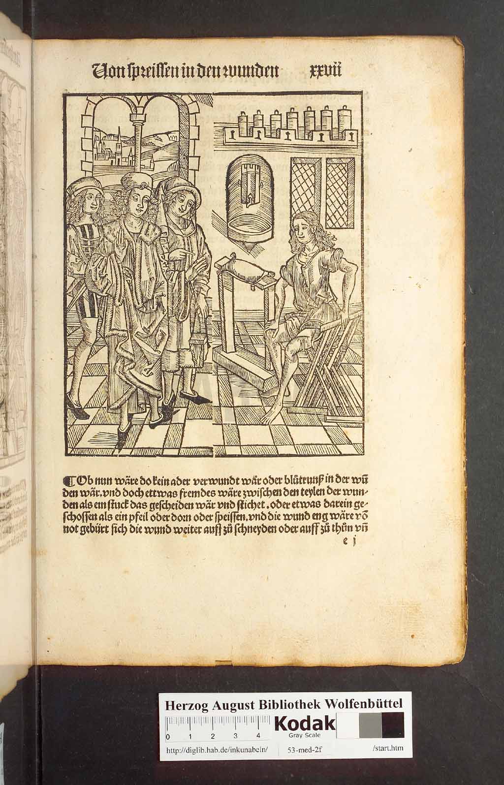http://diglib.hab.de/inkunabeln/53-med-2f/00051.jpg