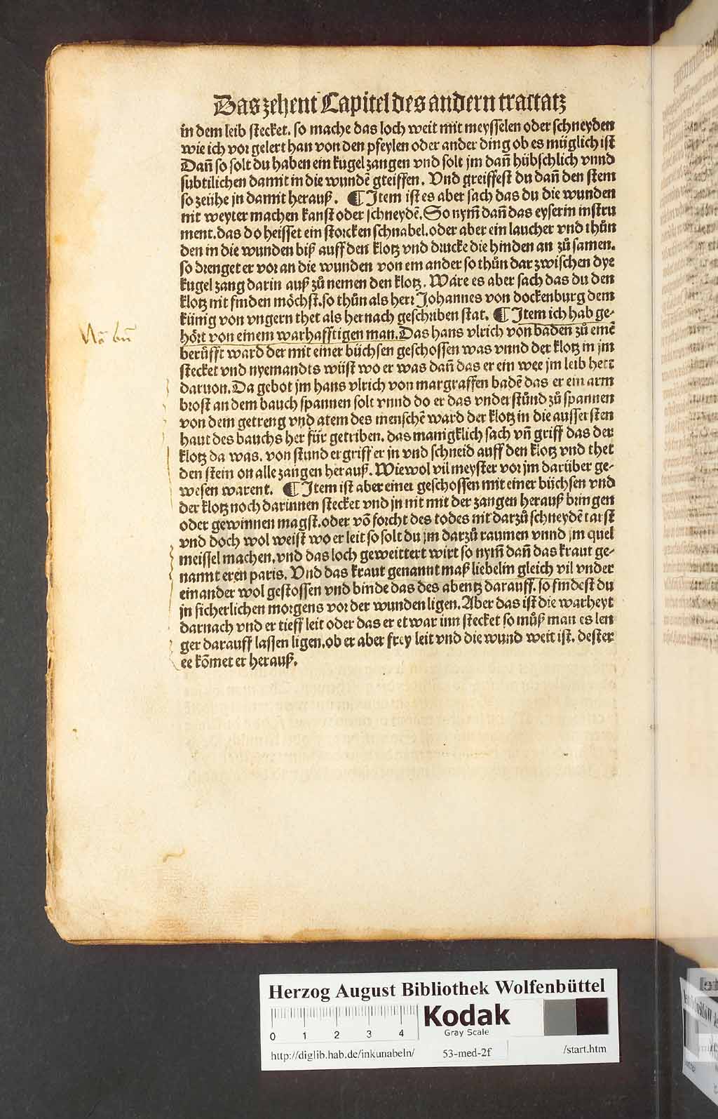 http://diglib.hab.de/inkunabeln/53-med-2f/00060.jpg