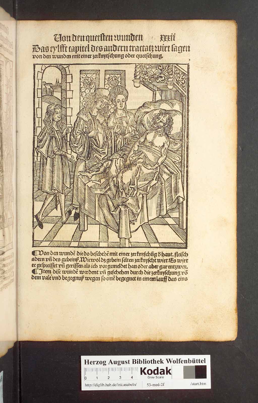 http://diglib.hab.de/inkunabeln/53-med-2f/00061.jpg