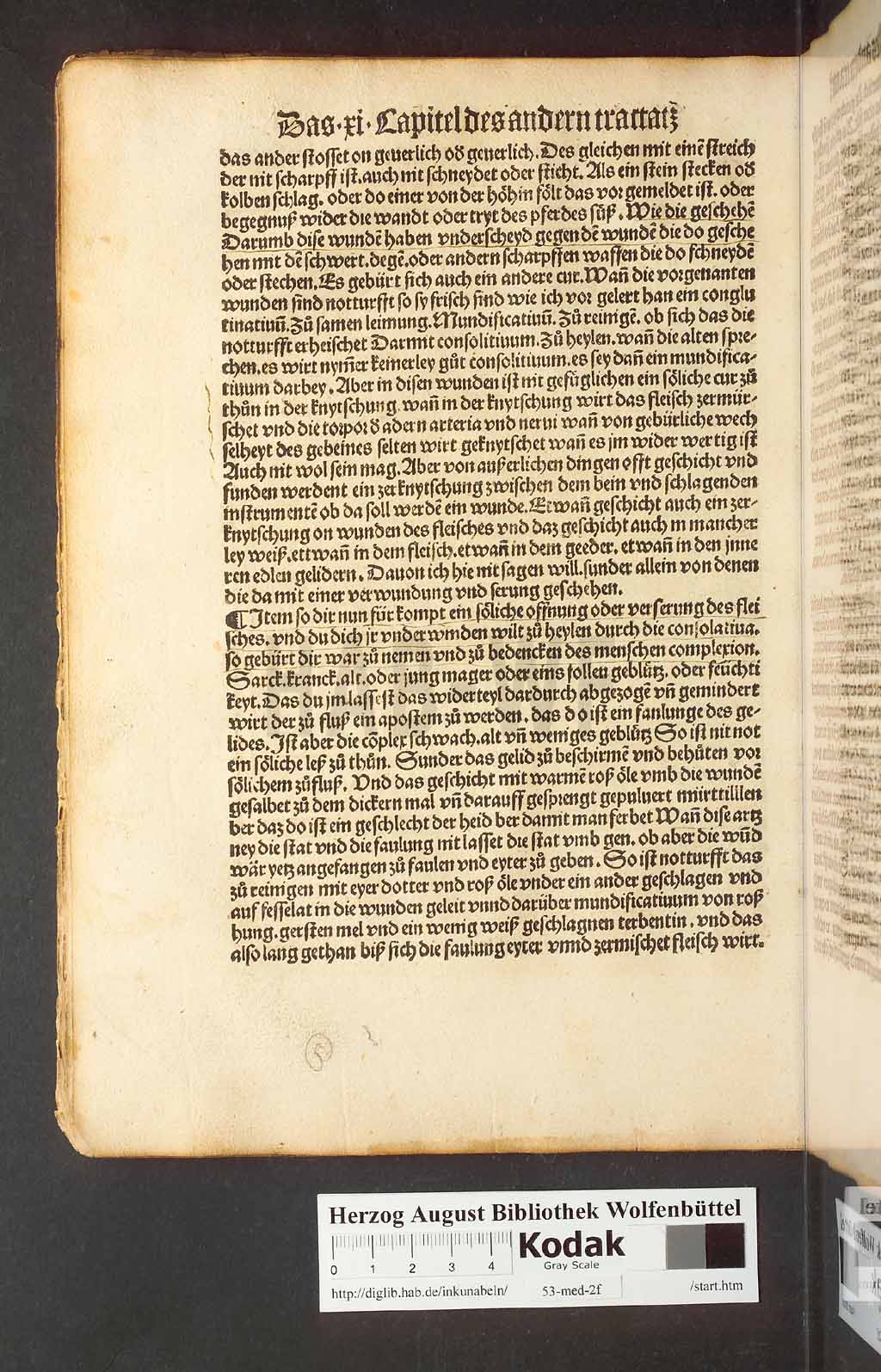 http://diglib.hab.de/inkunabeln/53-med-2f/00062.jpg