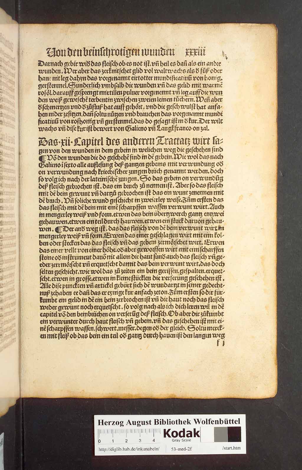 http://diglib.hab.de/inkunabeln/53-med-2f/00063.jpg