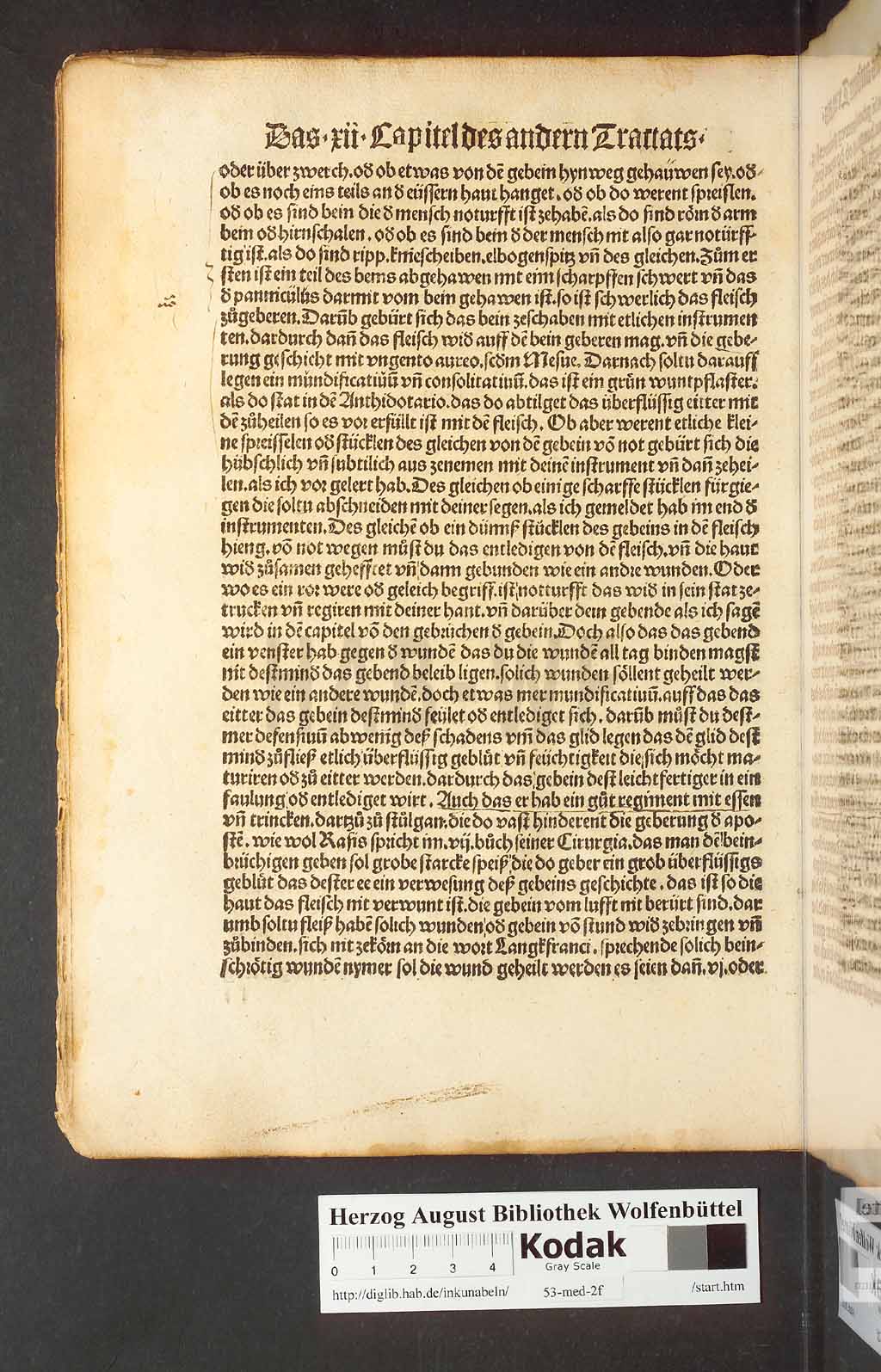 http://diglib.hab.de/inkunabeln/53-med-2f/00064.jpg