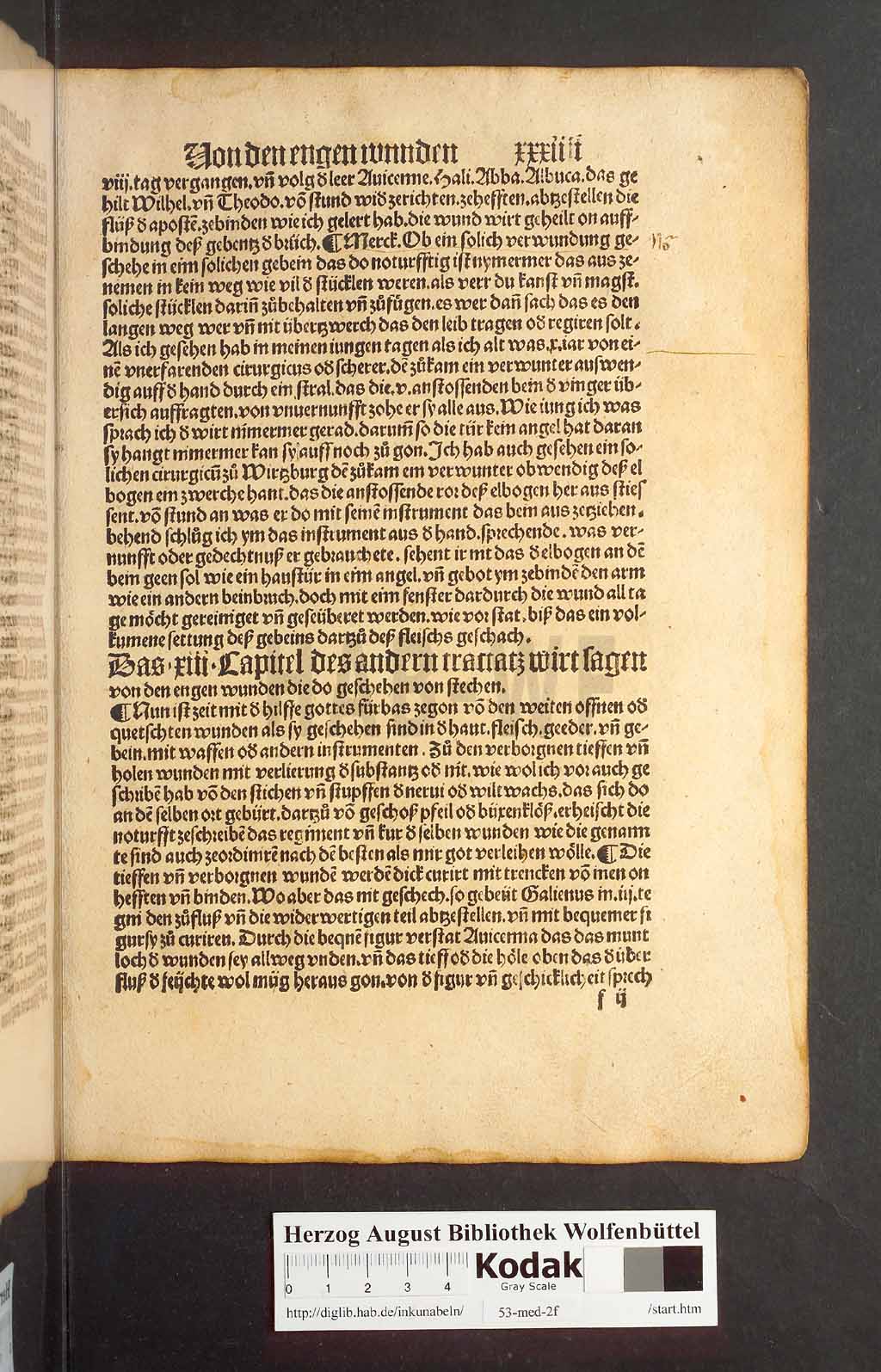 http://diglib.hab.de/inkunabeln/53-med-2f/00065.jpg