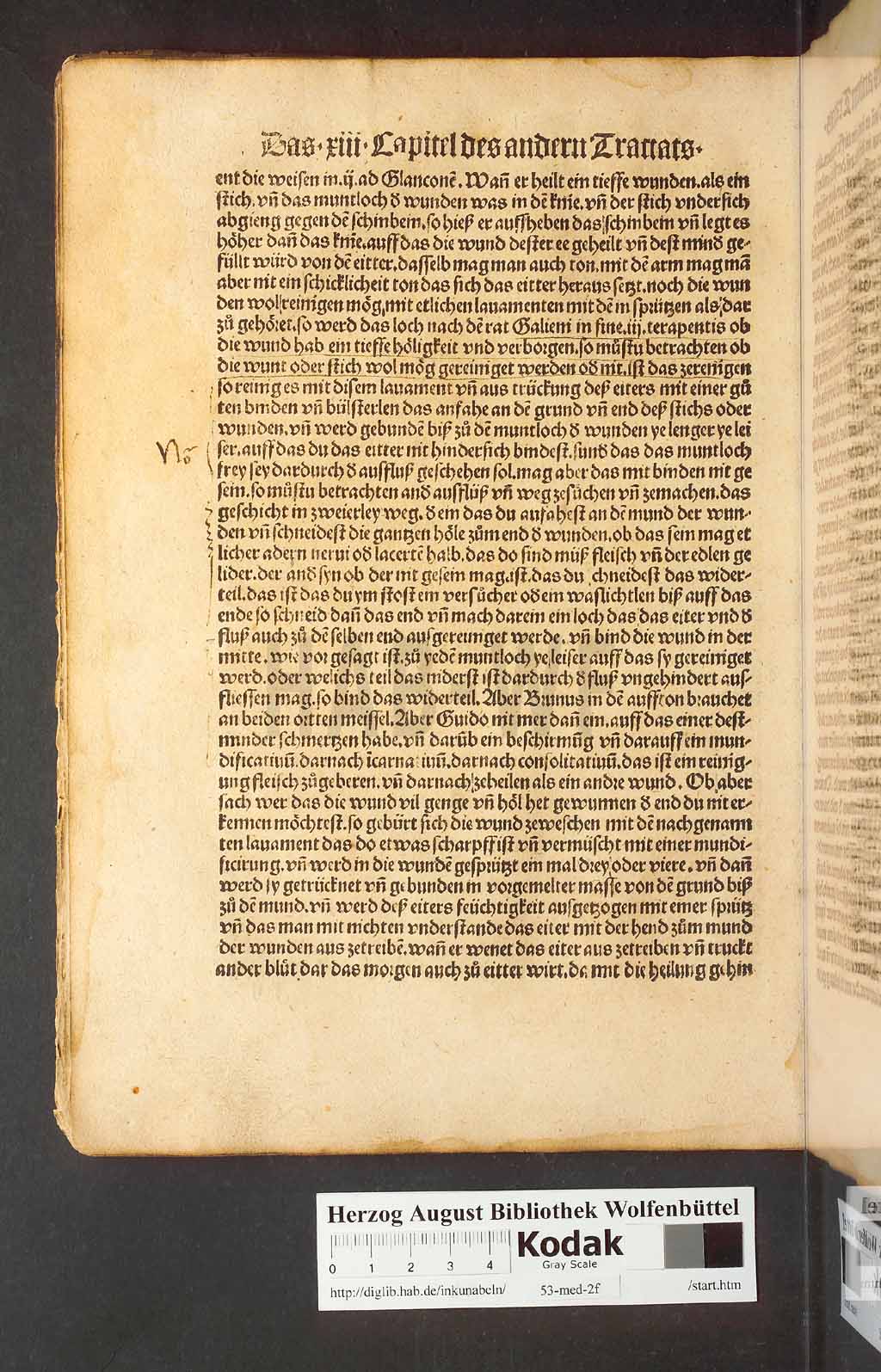 http://diglib.hab.de/inkunabeln/53-med-2f/00066.jpg