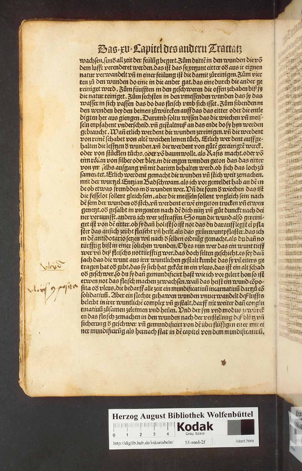 http://diglib.hab.de/inkunabeln/53-med-2f/00074.jpg