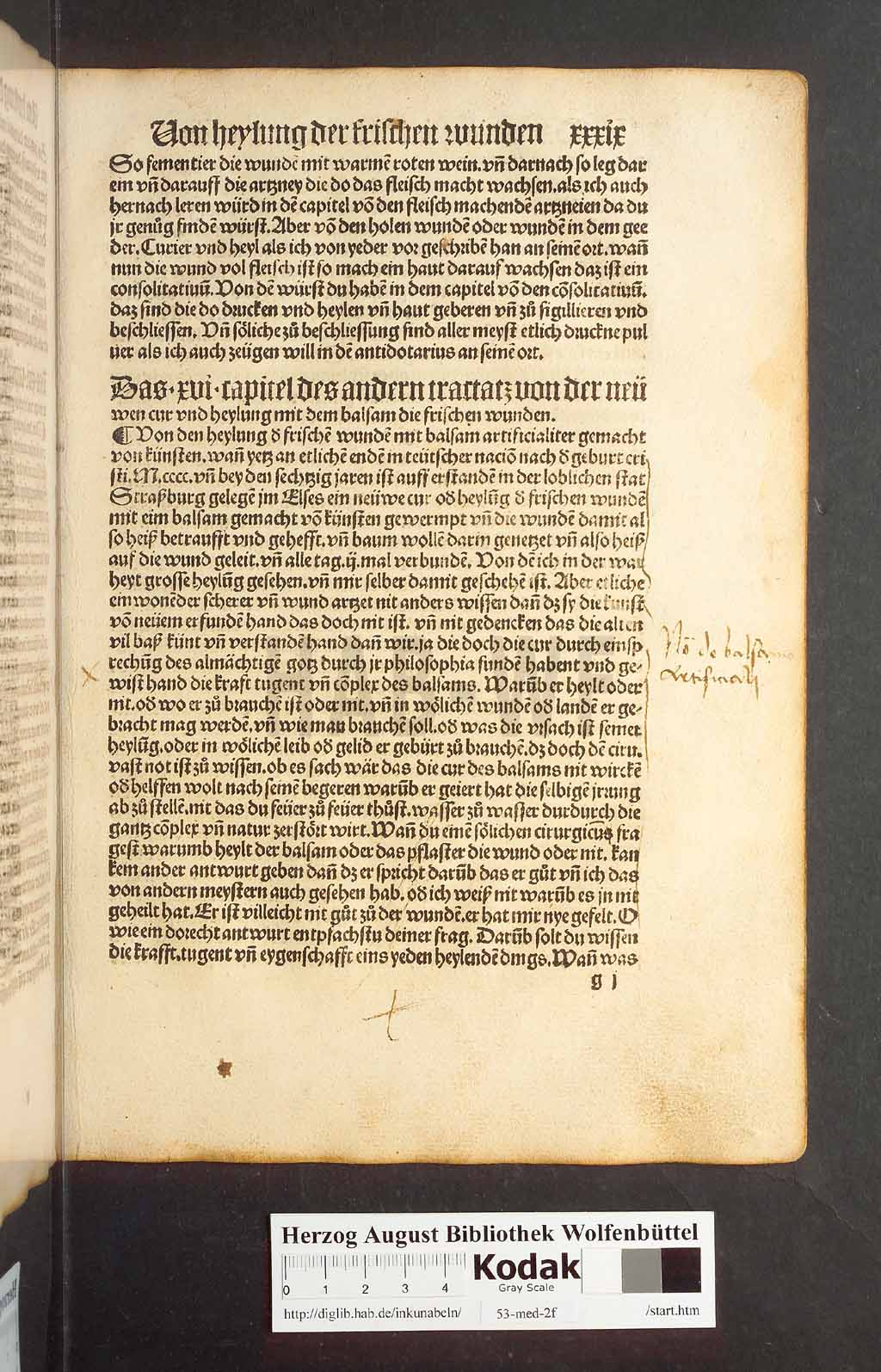 http://diglib.hab.de/inkunabeln/53-med-2f/00075.jpg