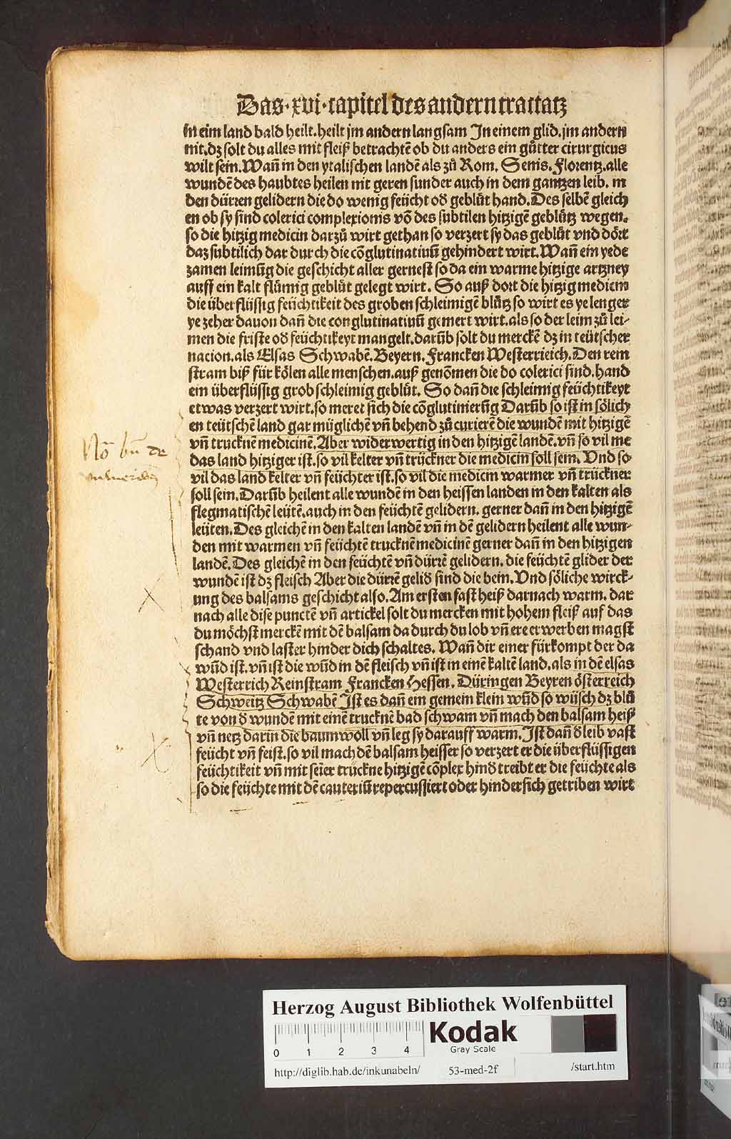 http://diglib.hab.de/inkunabeln/53-med-2f/00076.jpg
