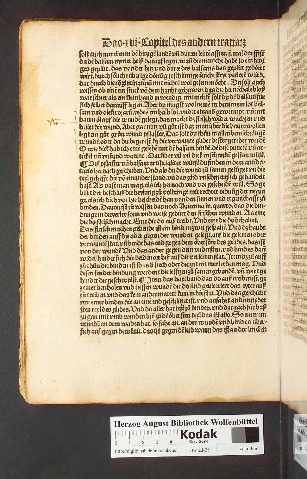 http://diglib.hab.de/inkunabeln/53-med-2f/00078.jpg