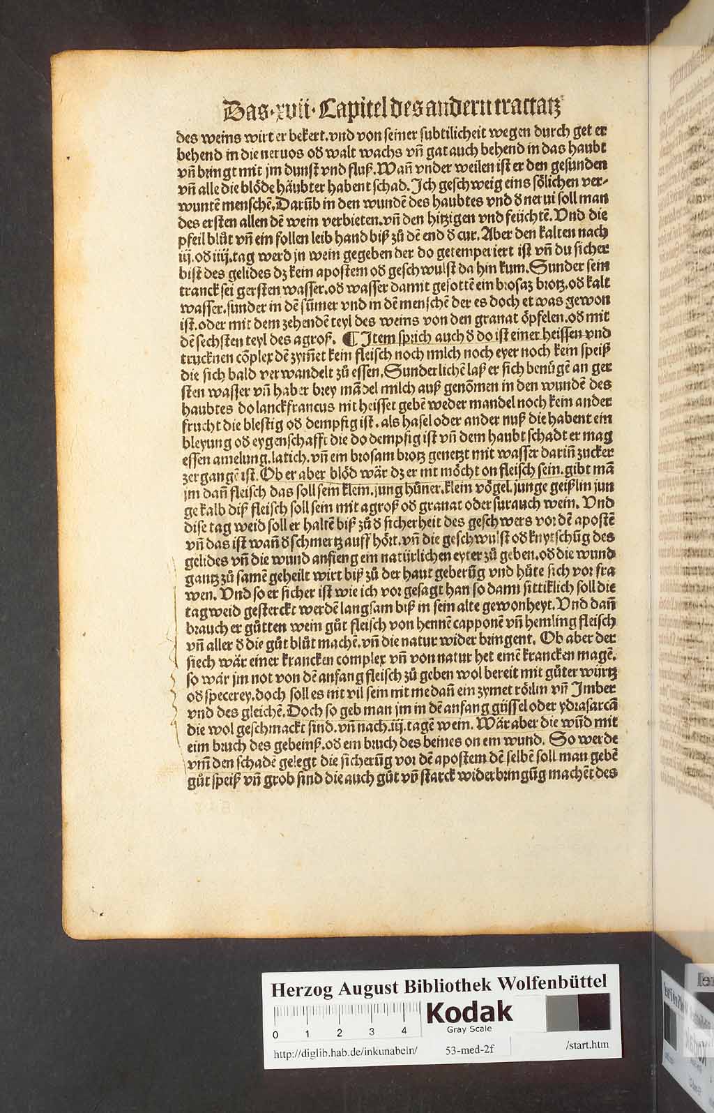 http://diglib.hab.de/inkunabeln/53-med-2f/00082.jpg