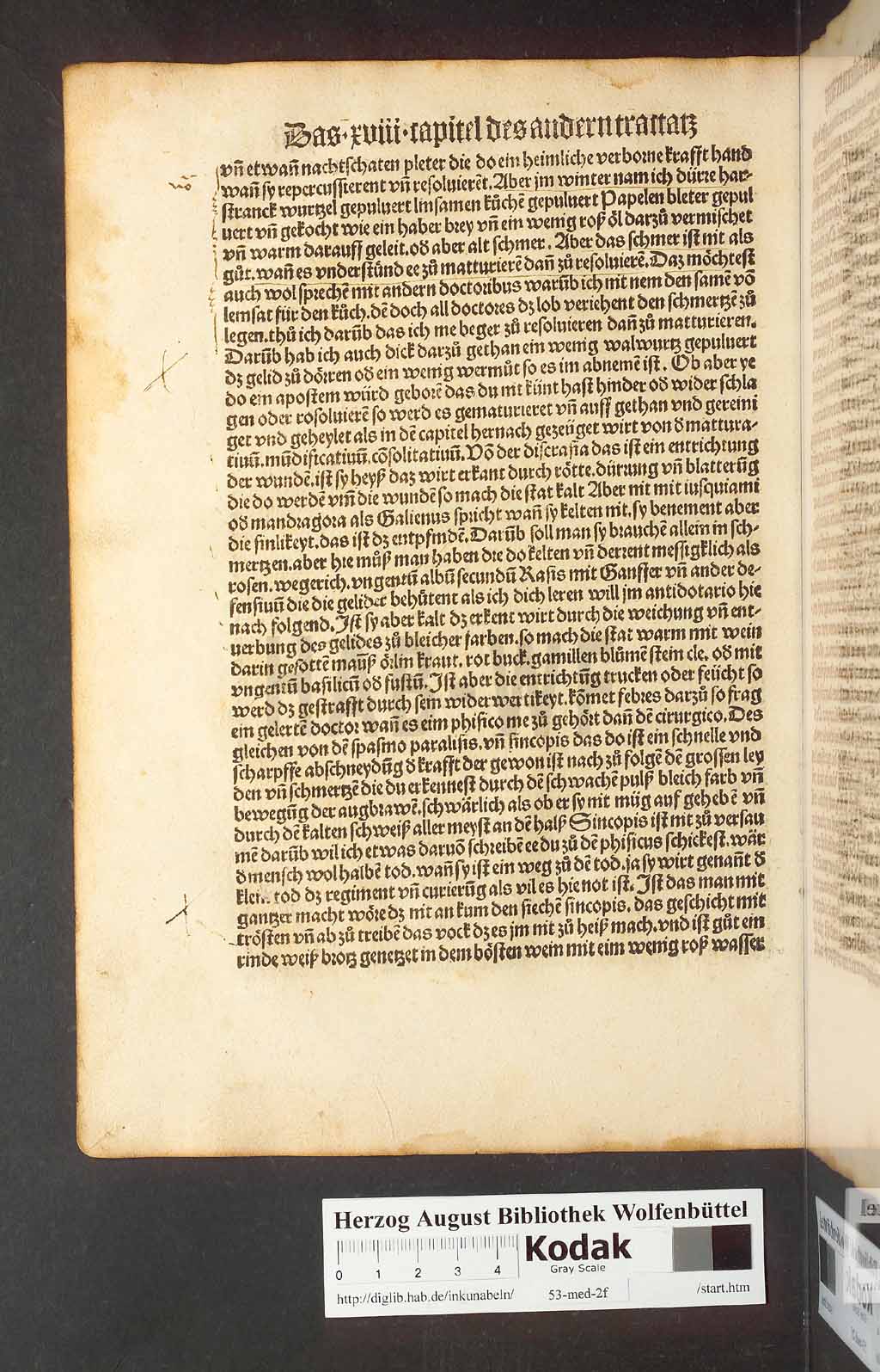 http://diglib.hab.de/inkunabeln/53-med-2f/00084.jpg