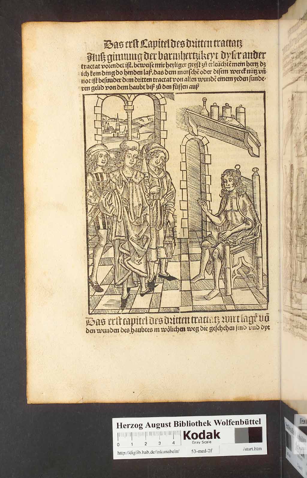 http://diglib.hab.de/inkunabeln/53-med-2f/00086.jpg
