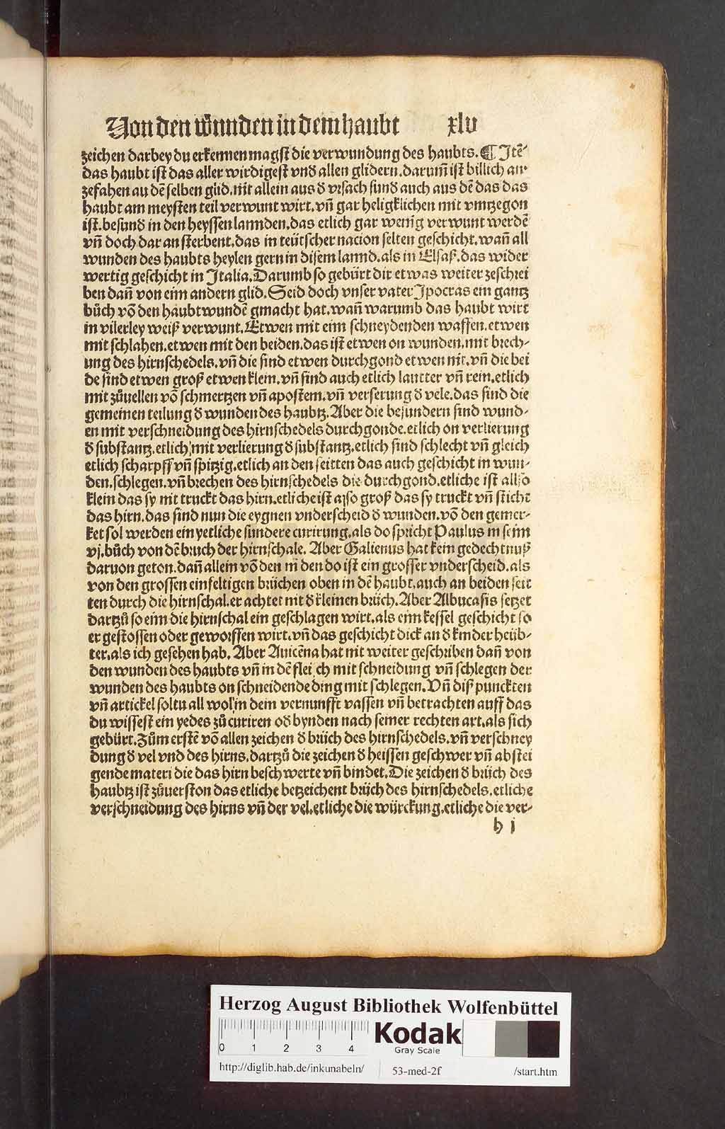 http://diglib.hab.de/inkunabeln/53-med-2f/00087.jpg