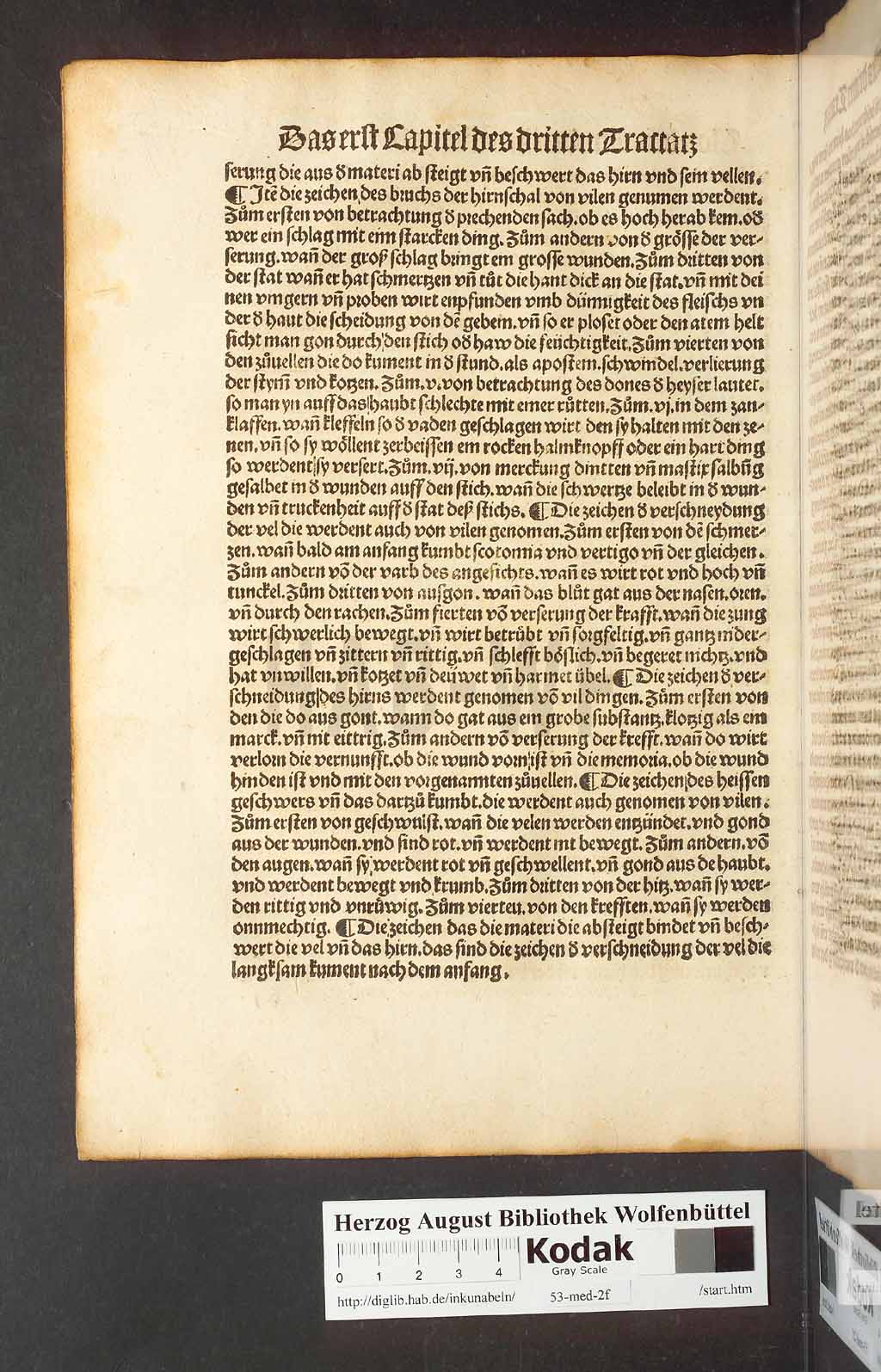 http://diglib.hab.de/inkunabeln/53-med-2f/00088.jpg