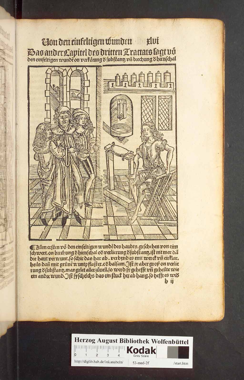 http://diglib.hab.de/inkunabeln/53-med-2f/00089.jpg