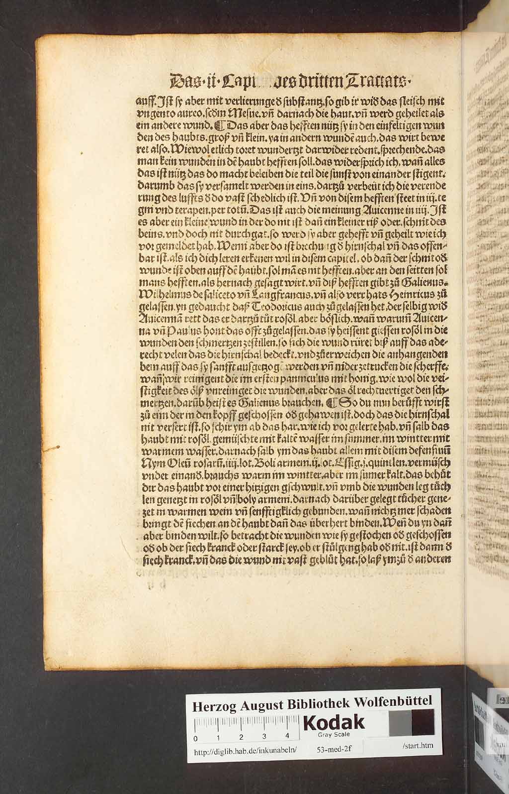 http://diglib.hab.de/inkunabeln/53-med-2f/00090.jpg