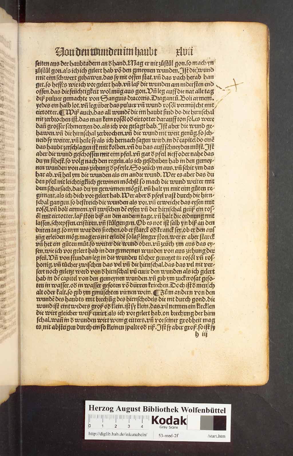 http://diglib.hab.de/inkunabeln/53-med-2f/00091.jpg