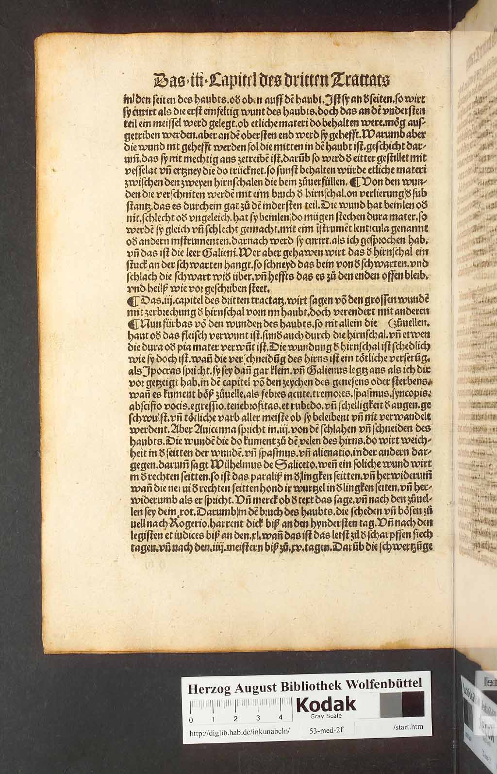 http://diglib.hab.de/inkunabeln/53-med-2f/00092.jpg