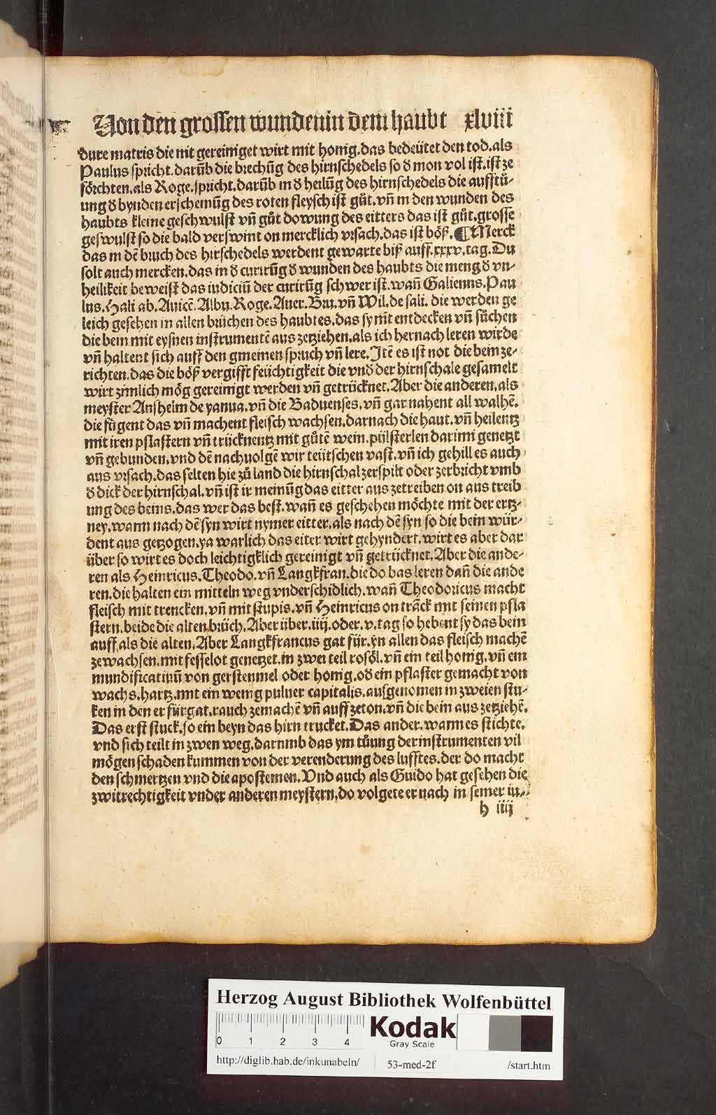 http://diglib.hab.de/inkunabeln/53-med-2f/00093.jpg
