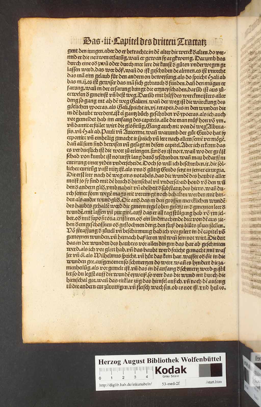 http://diglib.hab.de/inkunabeln/53-med-2f/00094.jpg